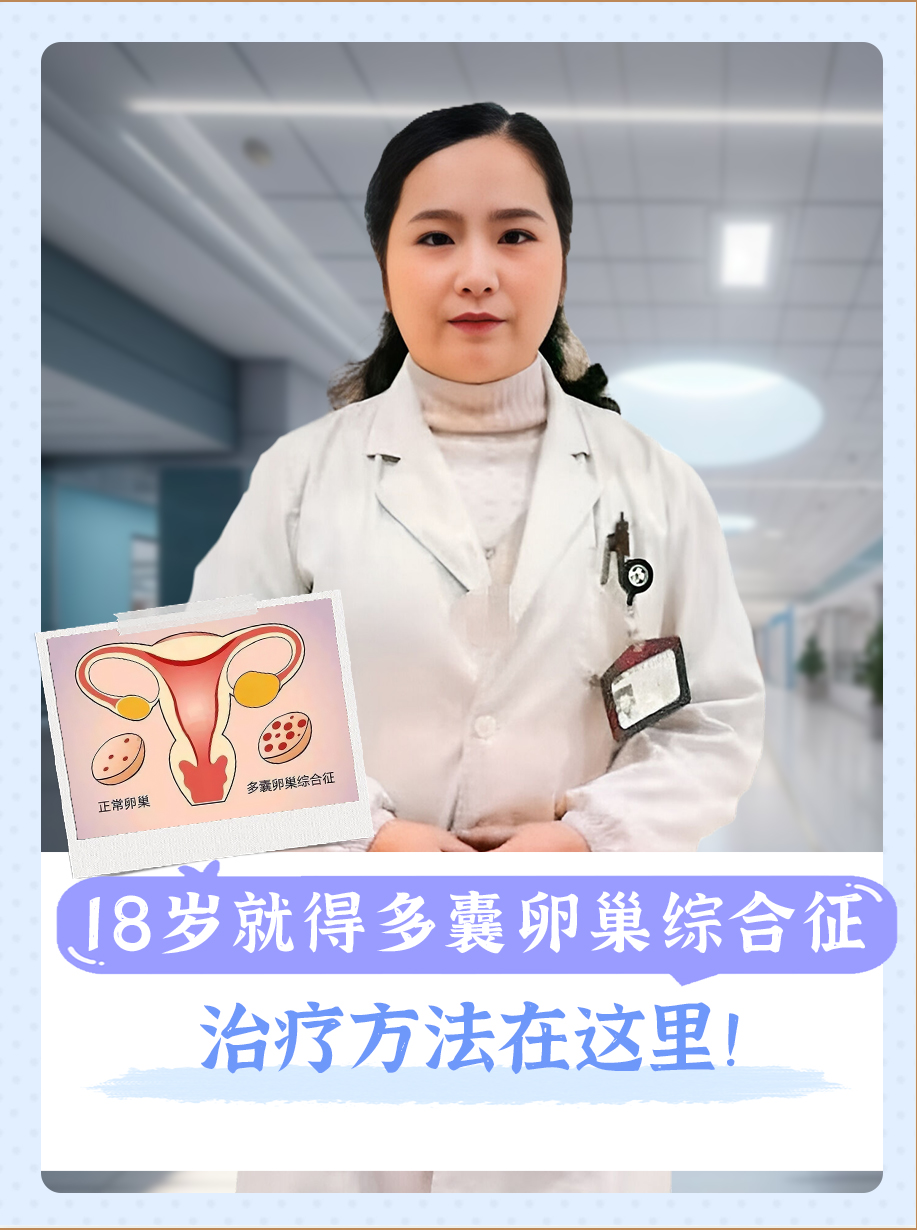 多囊性卵巢综合症的医院_多囊卵巢综合征哪个医院好  第2张