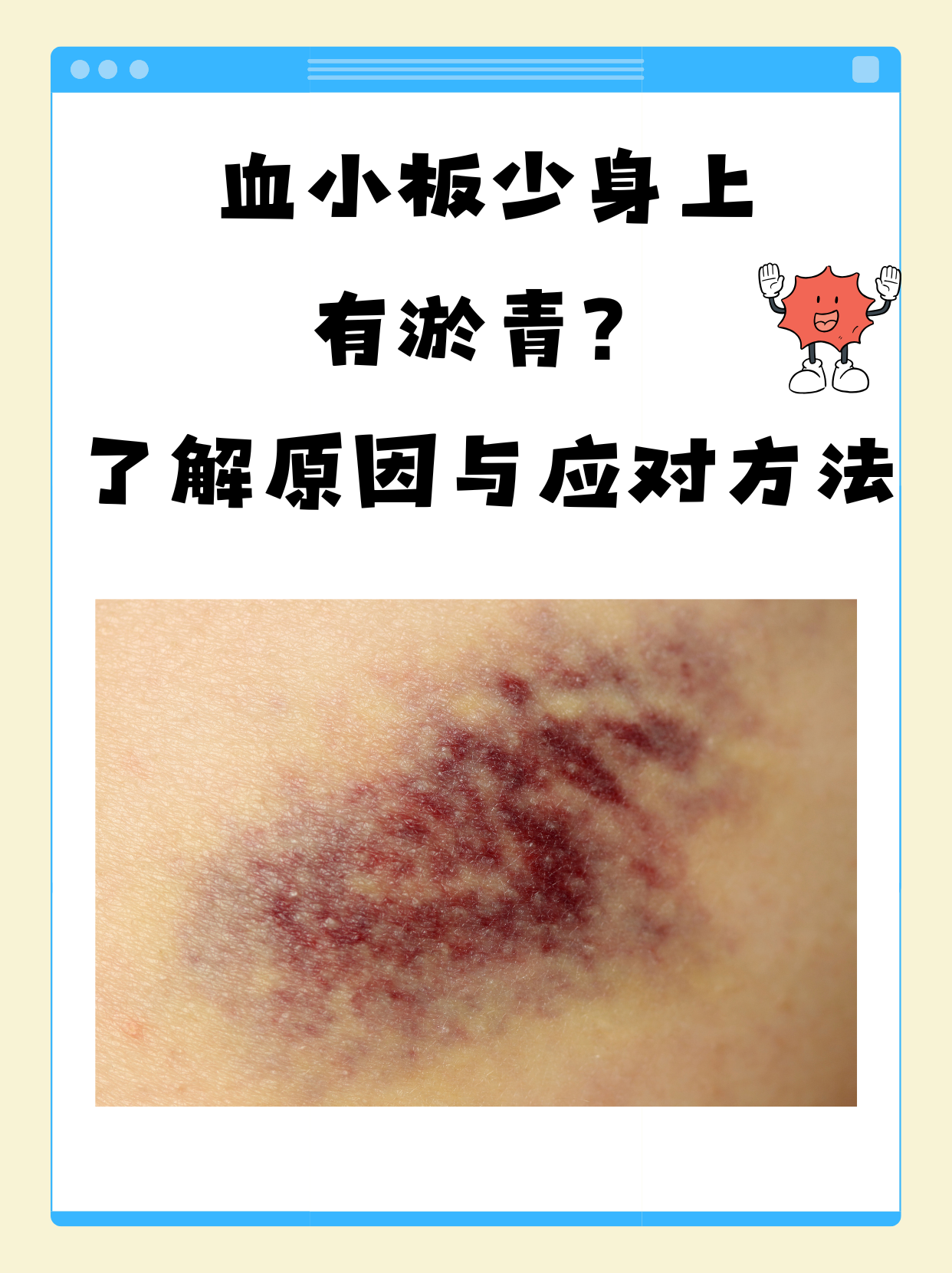 为什么血小板会低 为什么血小板会低