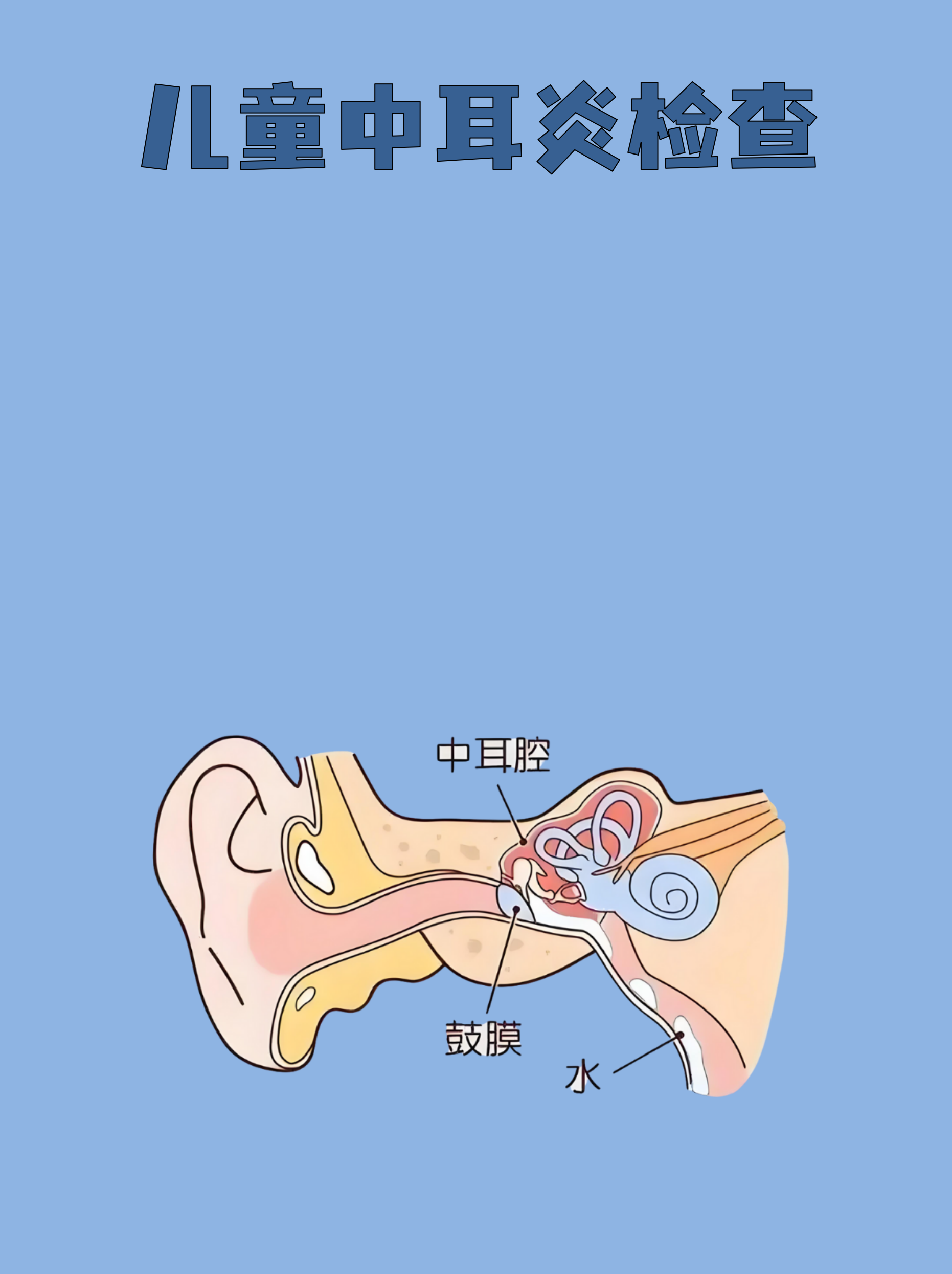 儿童中耳炎是常见的耳部感染,早期发现能有效避免