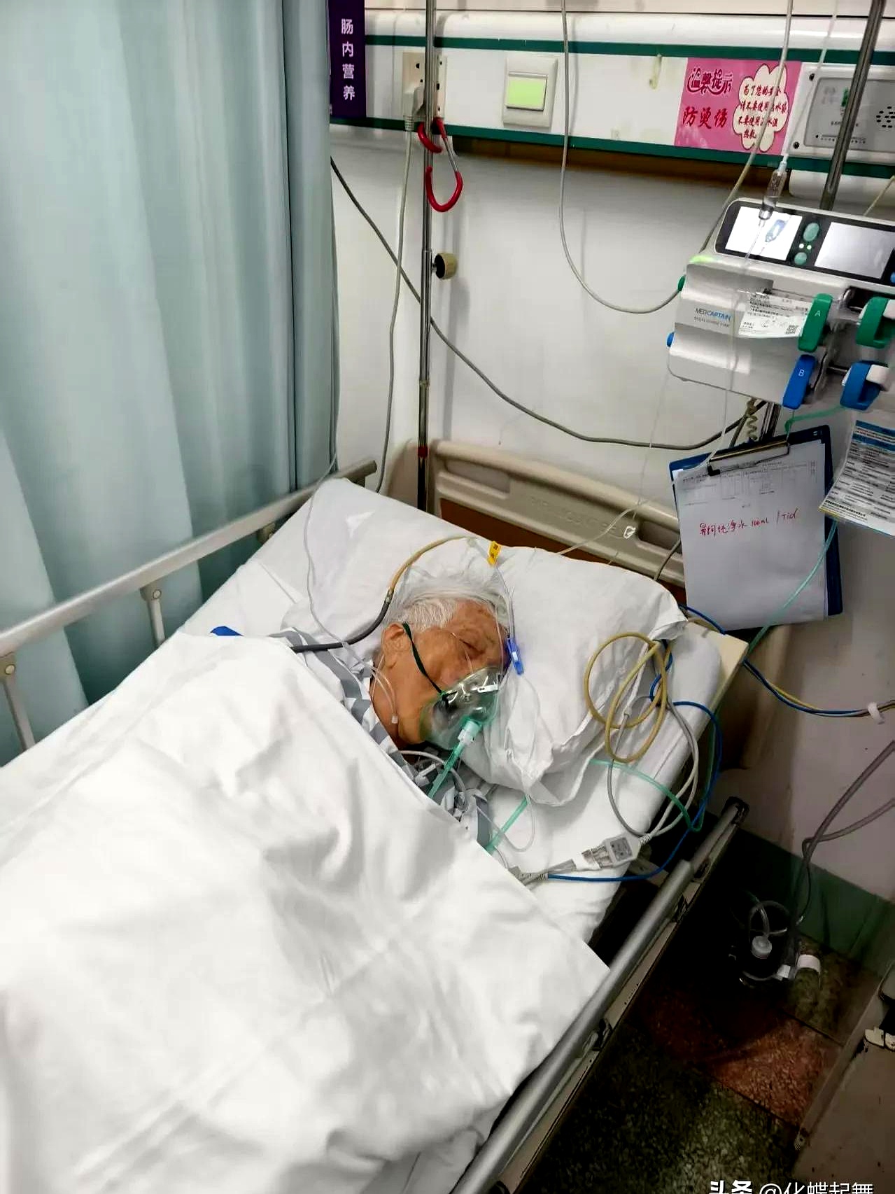 重症监护室的老人照片奶奶头上缝十针住院奶奶紧急住院70岁老人躺在