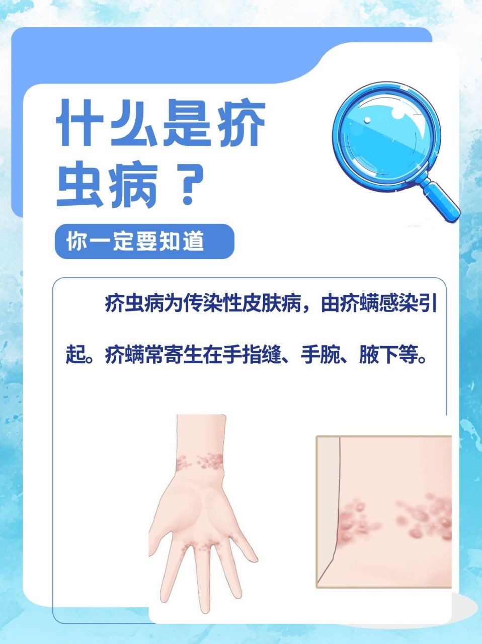 95疥虫病是一种由疥螨感染引起的传染性皮肤病.