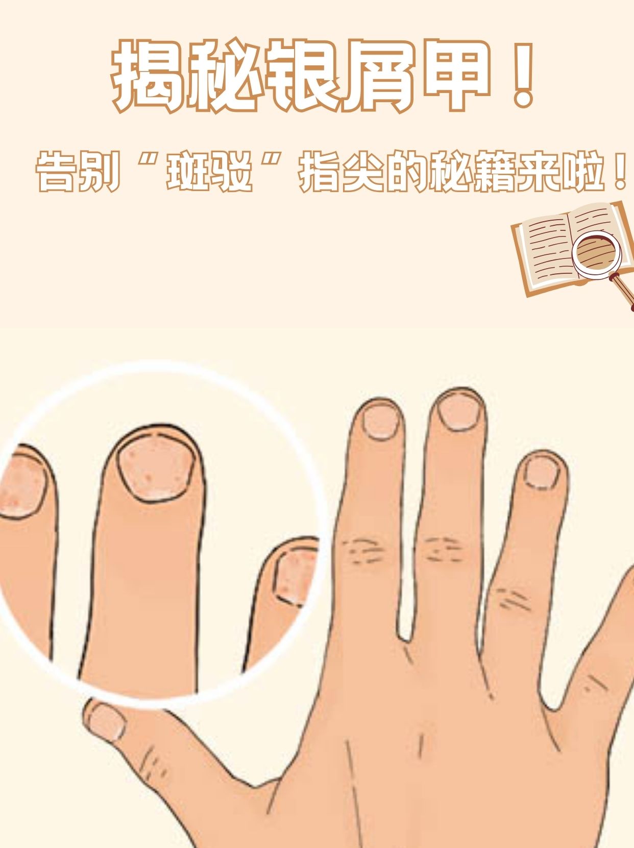 指甲表面会变得不平整,出现凹凸形状,甚至可能出现横沟和畸形