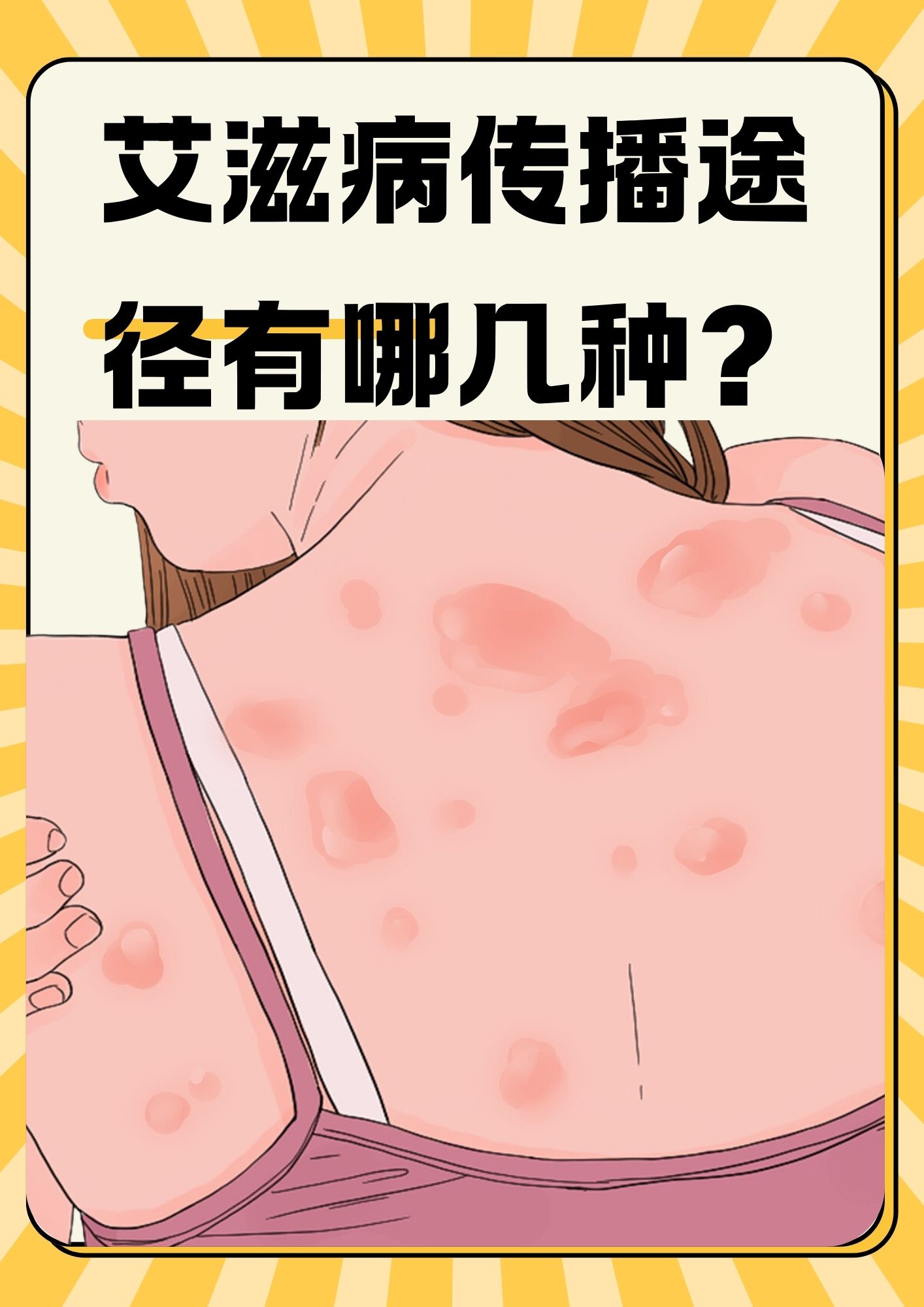 为什么会有艾滋病 为什么会有艾滋病