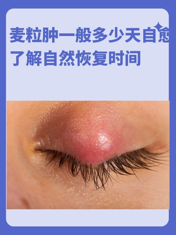 麦粒肿就是一种常见的眼部问题,很多人在长麦粒肿后,都急切地想知道它