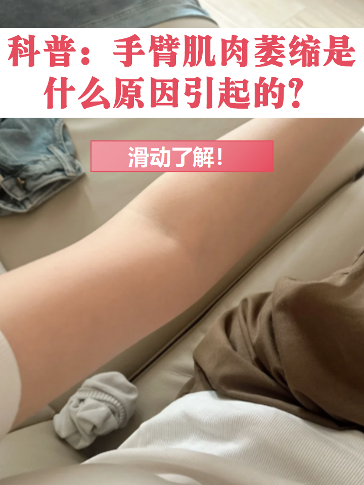 大家知道什么是肌肉萎缩吗?