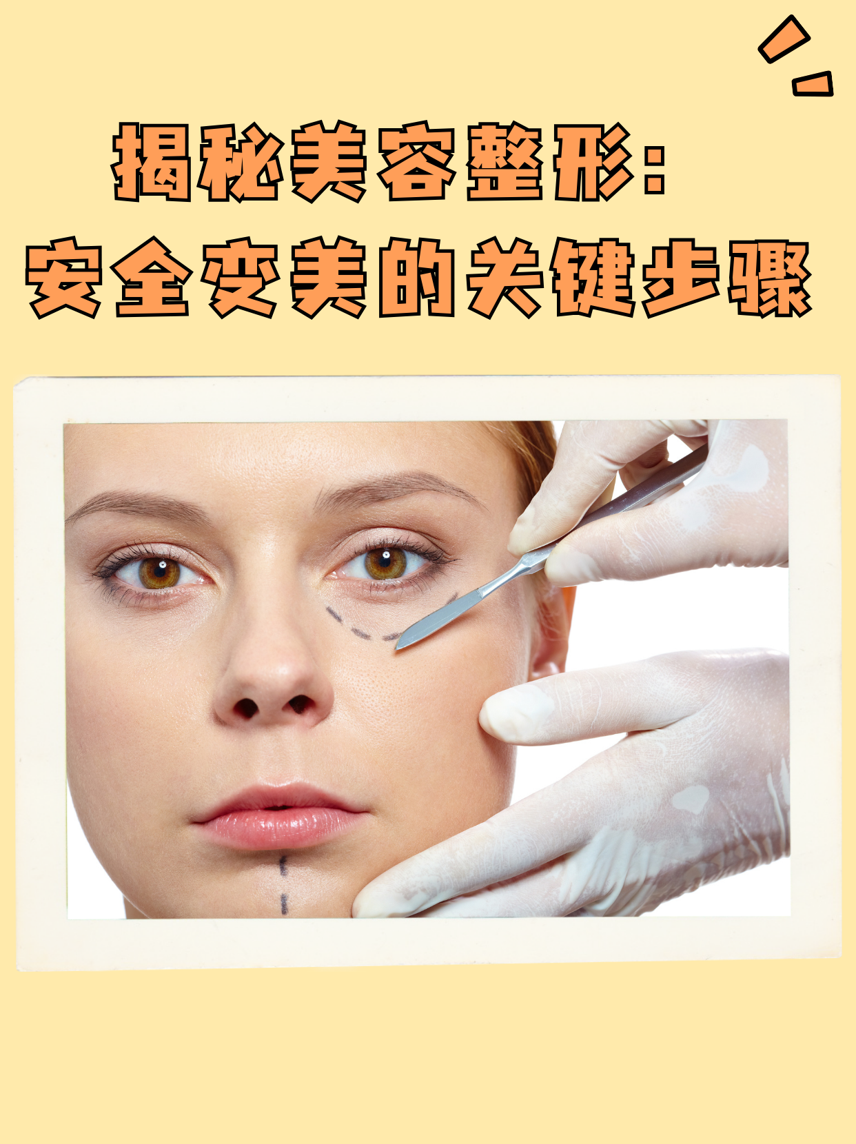 整形美容沟通（整形怎么谈美容院相助

）