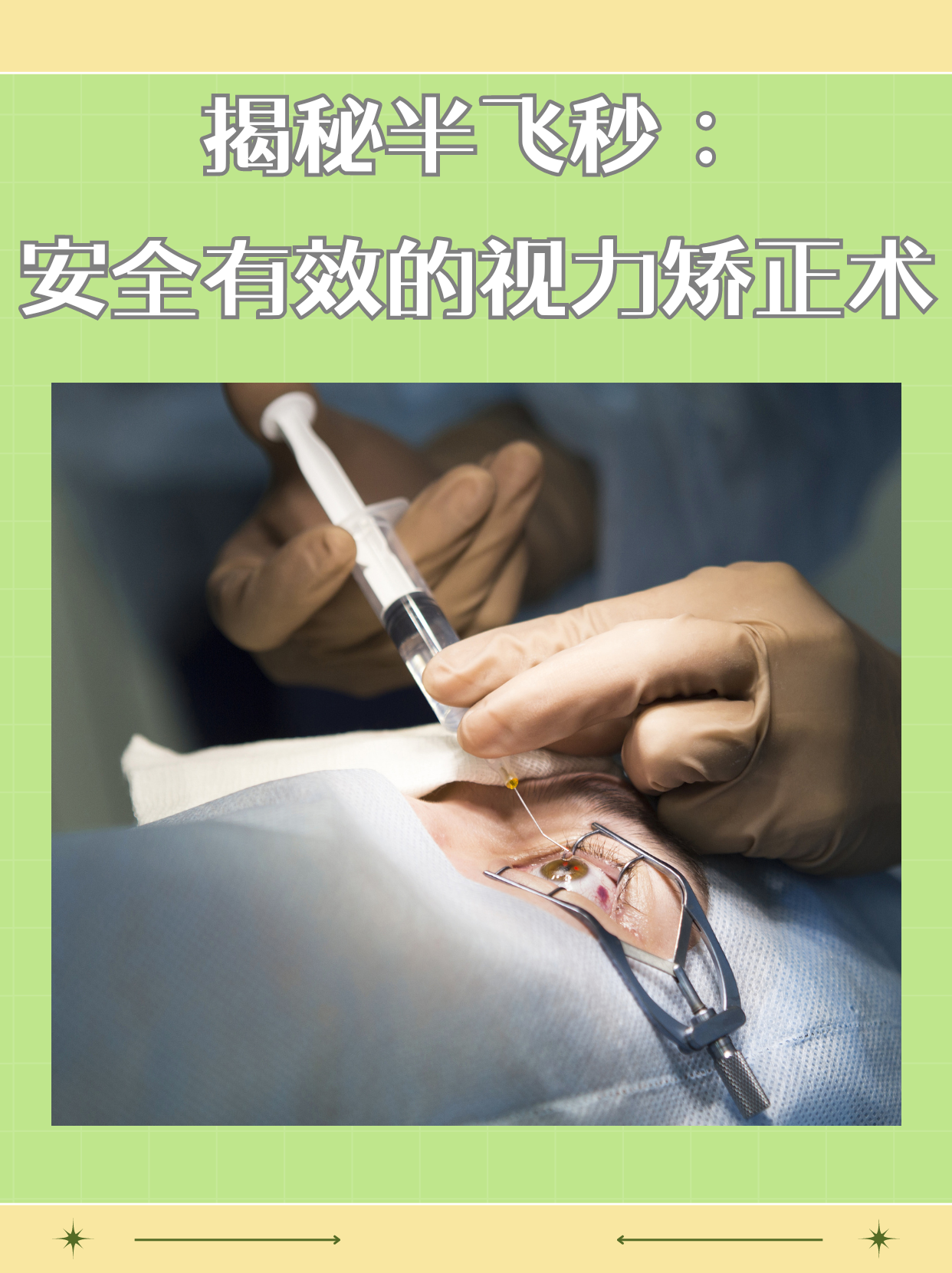 揭秘半飞秒:安全有效的视力矫正术[比分] 半飞秒手术,全称飞秒激光