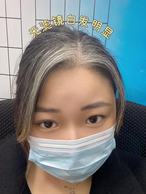 小孩为什么会长白发还生长发育百科在线 小孩为什么会长白发还生长发育百科在线