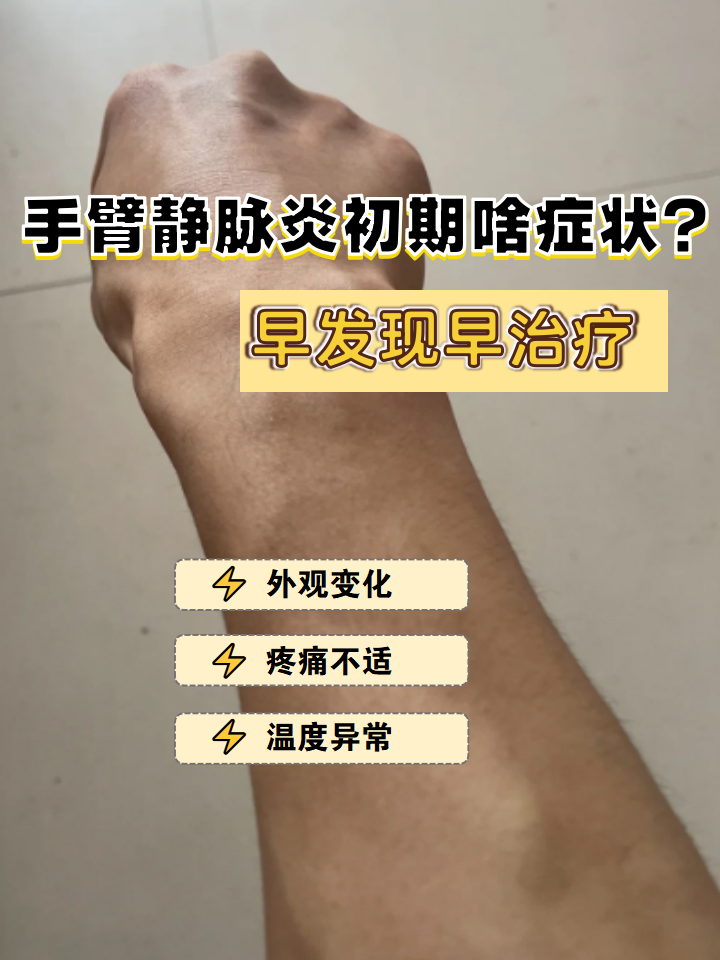 上肢血栓性静脉炎手肘窝处血管疼胳膊脉管炎是什么症状手肘关节有血栓