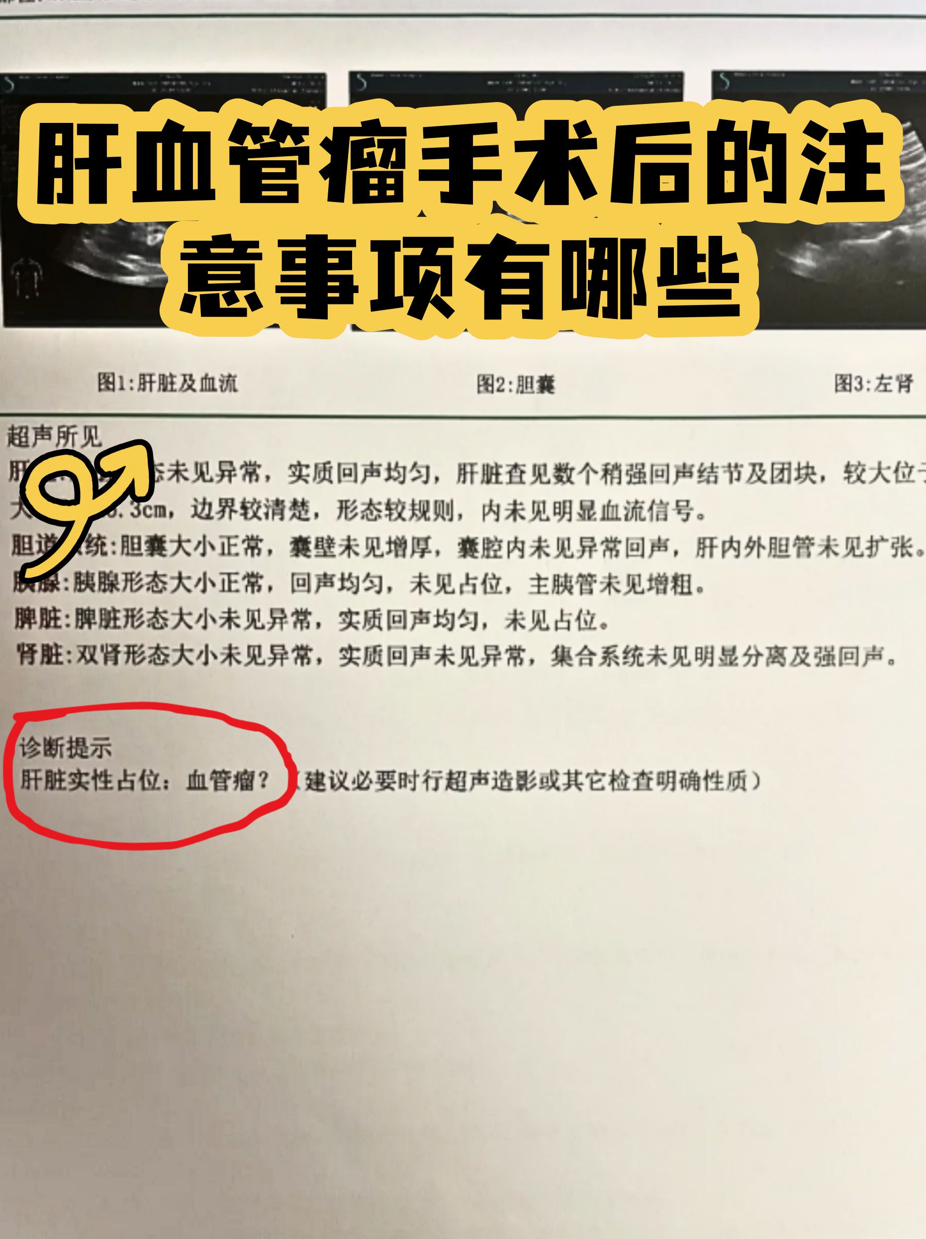 西苑医院代诊挂号服务流程出院后护理提醒,恢复更科学的简单介绍 西苑医院代诊挂号服务流程出院后护理提醒,恢复更科学的简单介绍