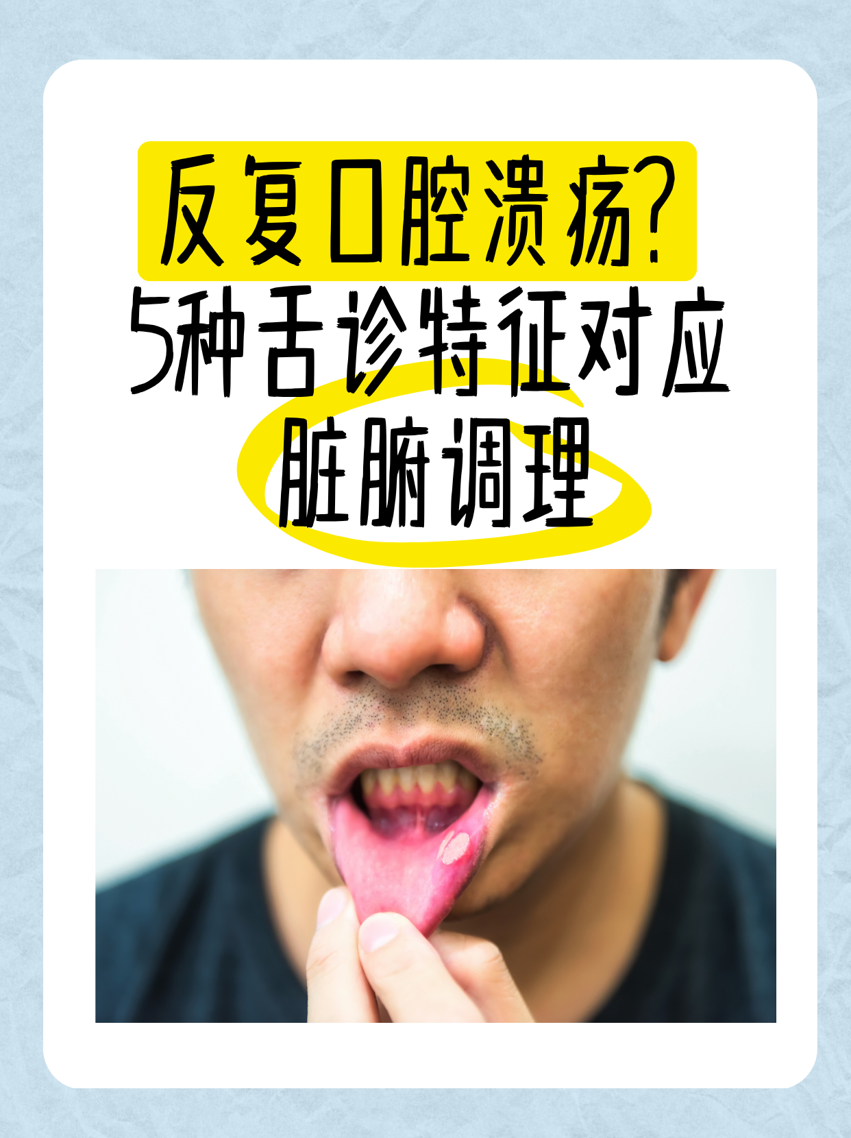 为什么口腔溃疡反复发作 为什么口腔溃疡反复发作