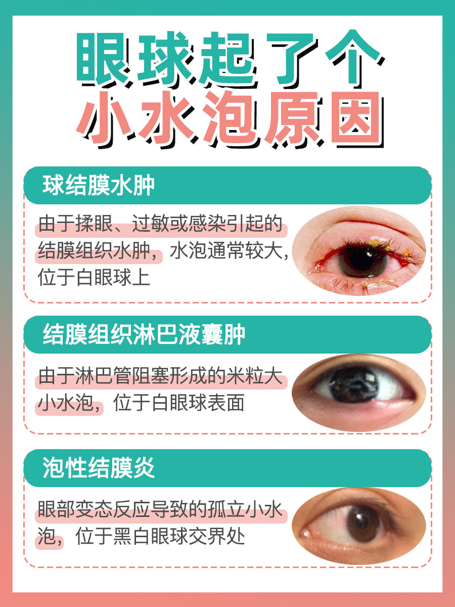 眼球起了个小水泡图片