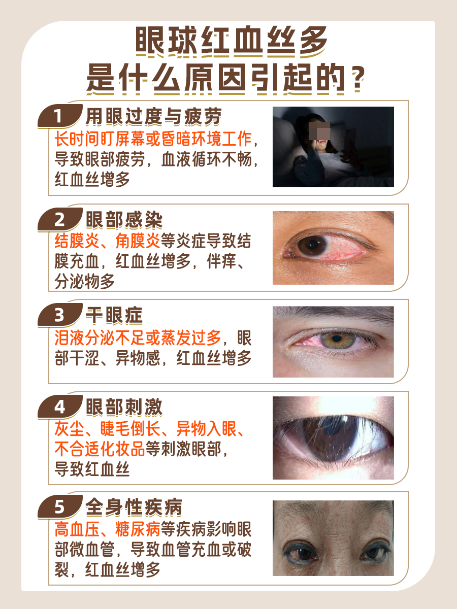 眼球红血丝大起底,原因竟然这么简单?