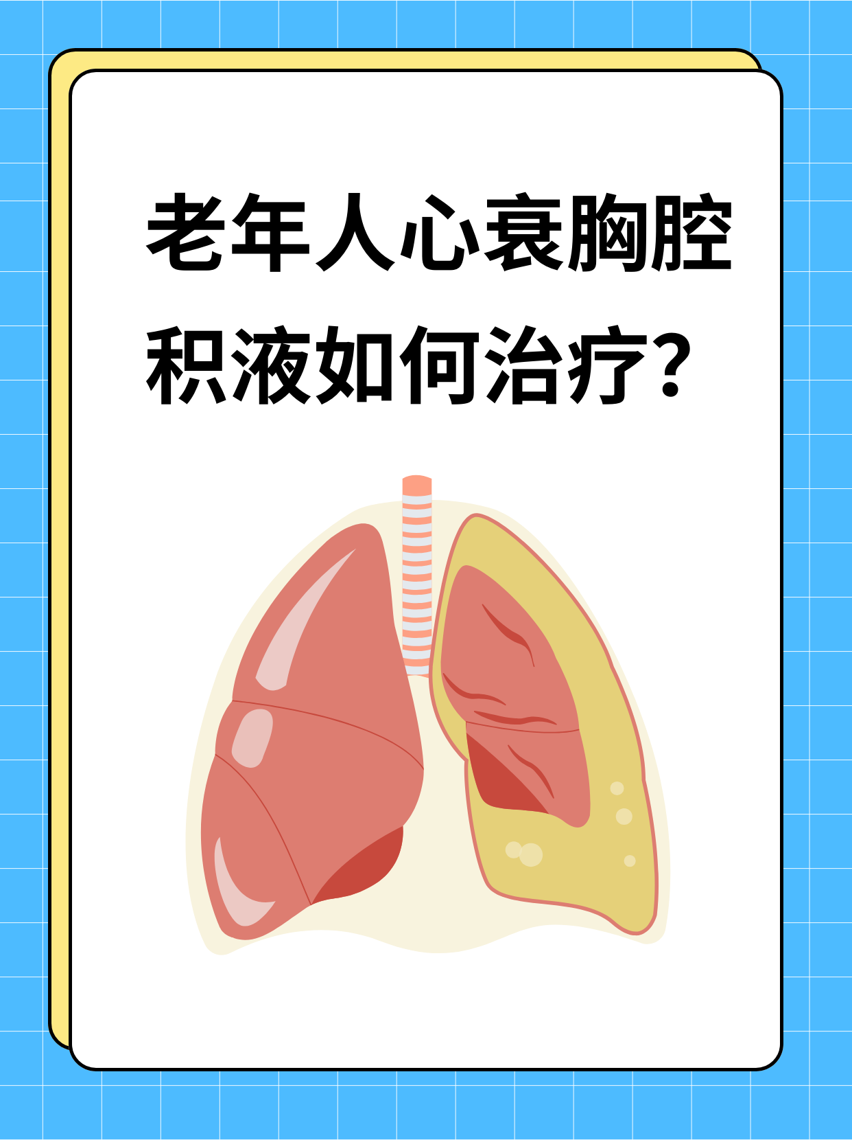 心衰会引起水肿吗怎么治疗百科在线 心衰会引起水肿吗怎么治疗百科在线