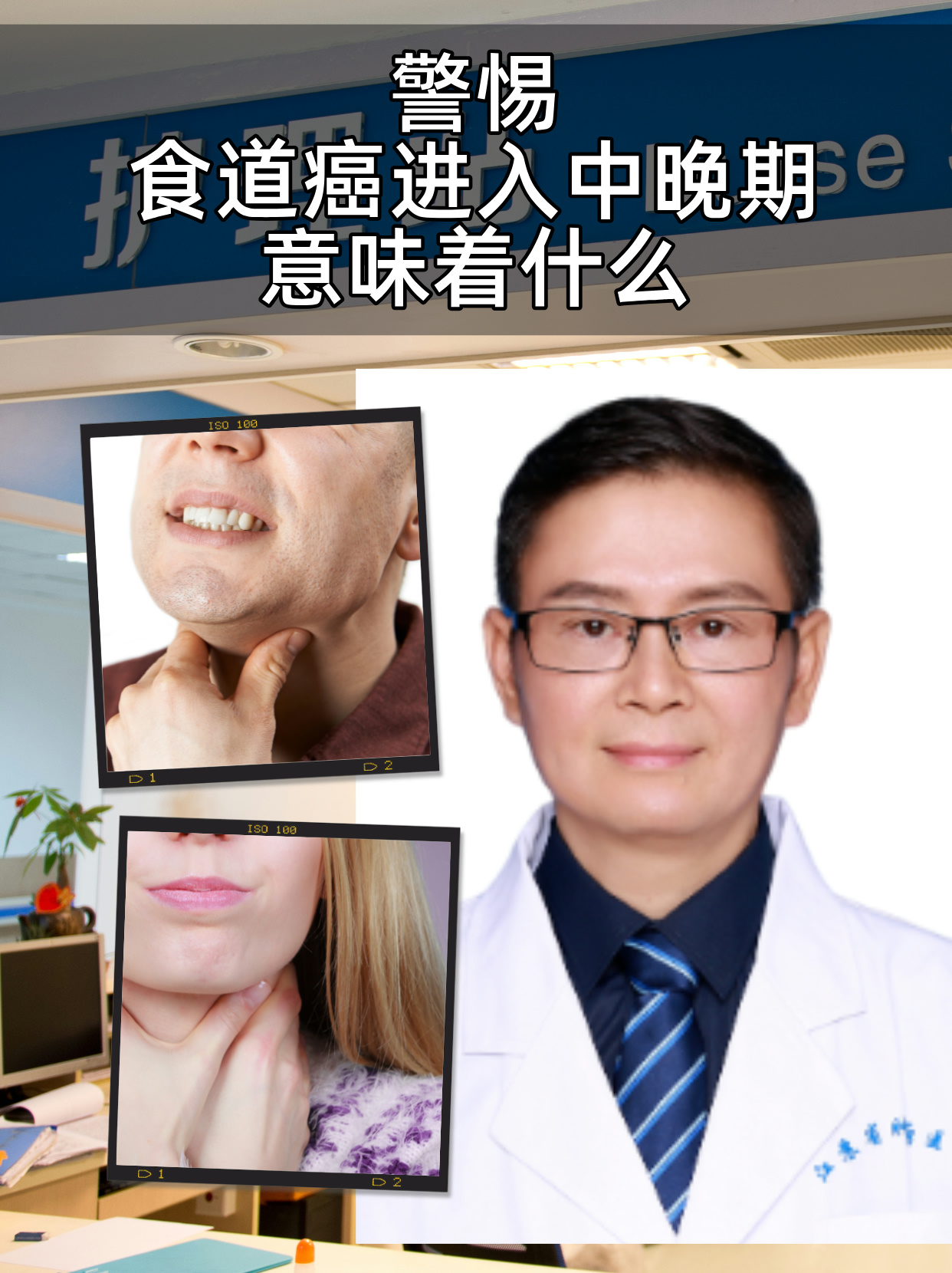 发现已经进入到了中晚期阶段,这也食道癌晚期现状食道癌晚期能活多久