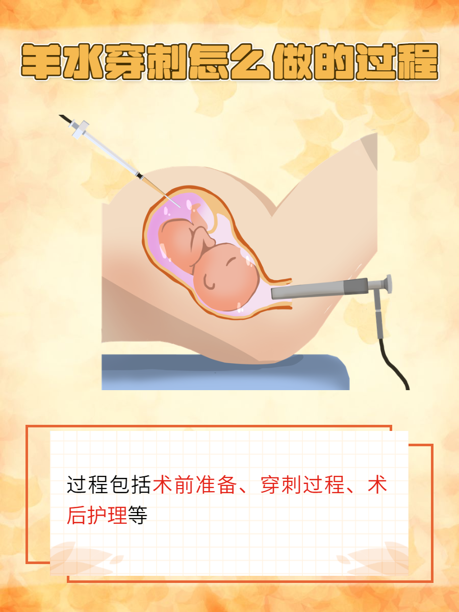 羊水穿刺怎么做的过程?