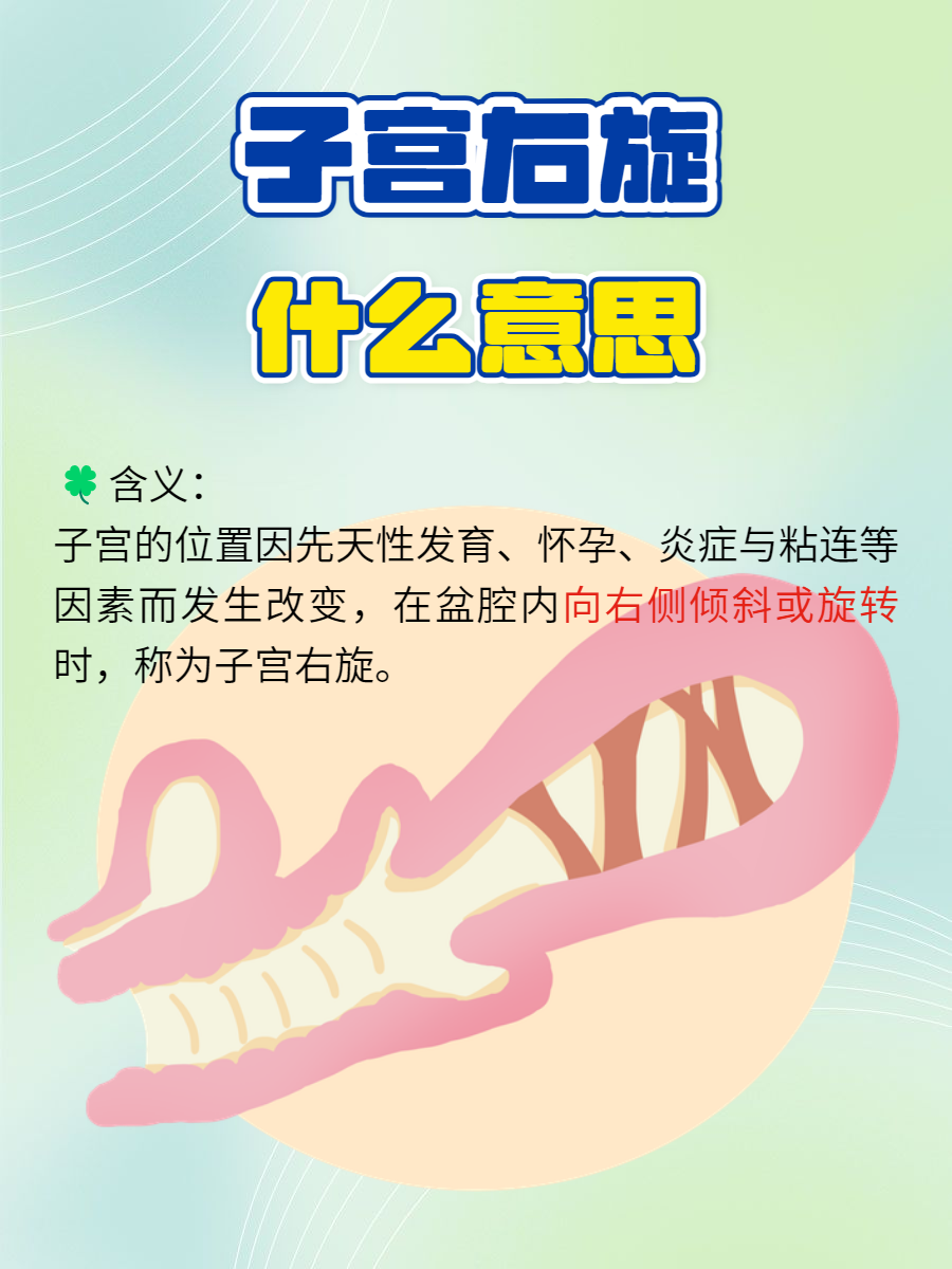 子宫右旋什么意思?