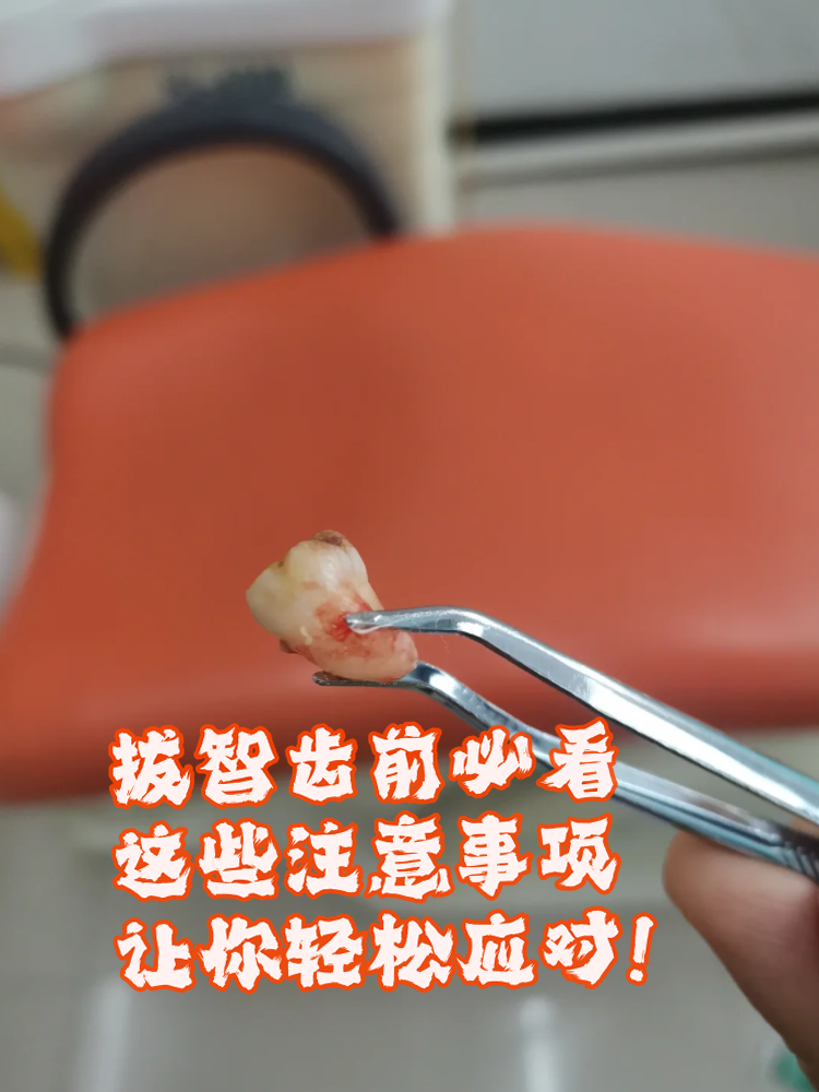 为什么拔智齿要上下一起拔为什么在线