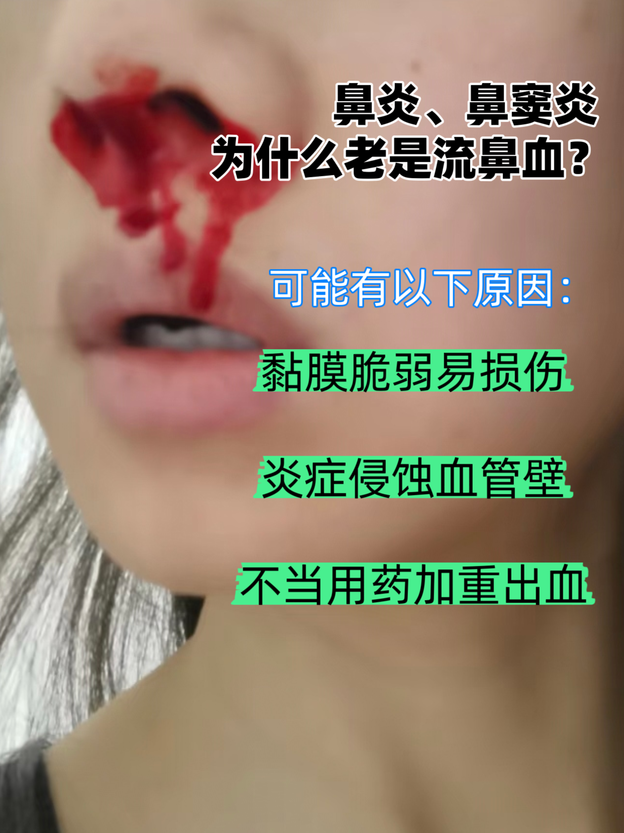 鼻子为什么流鼻血