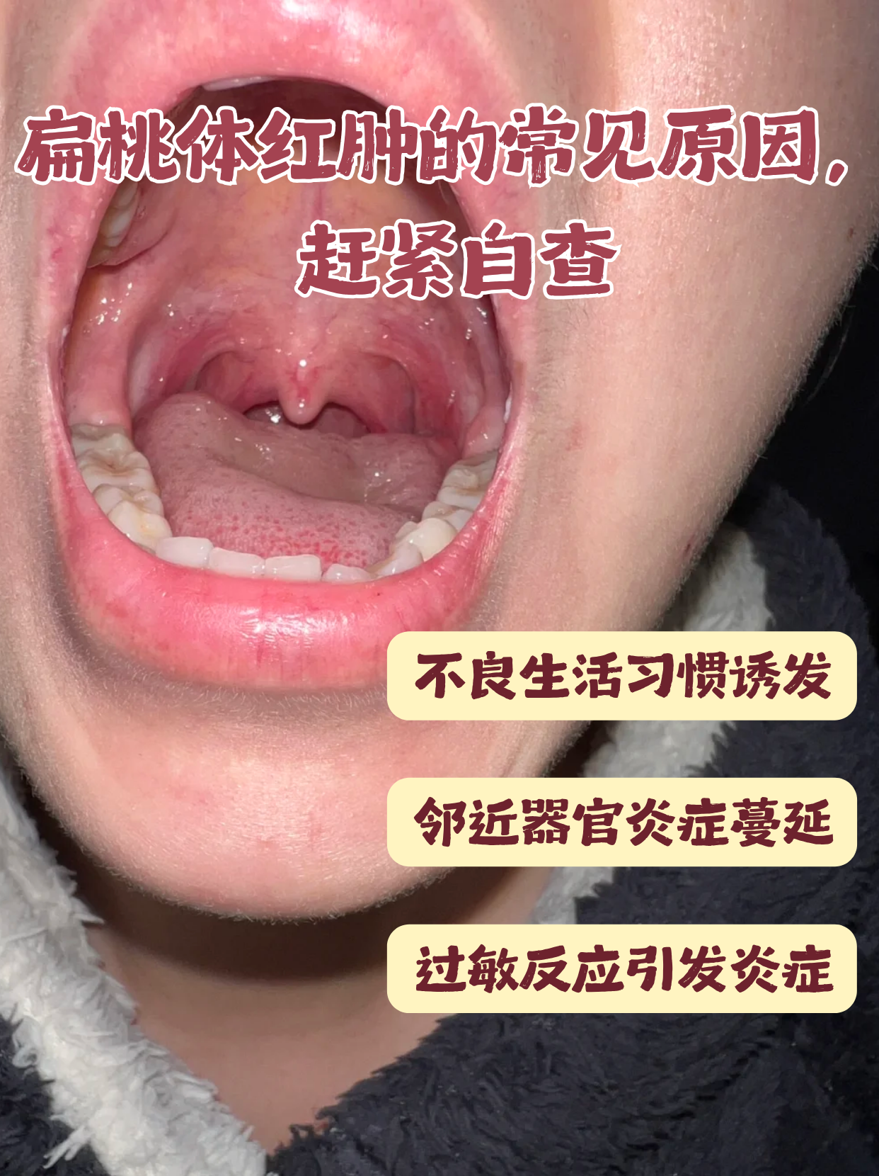 今天就来揭秘扁桃体红肿的原因