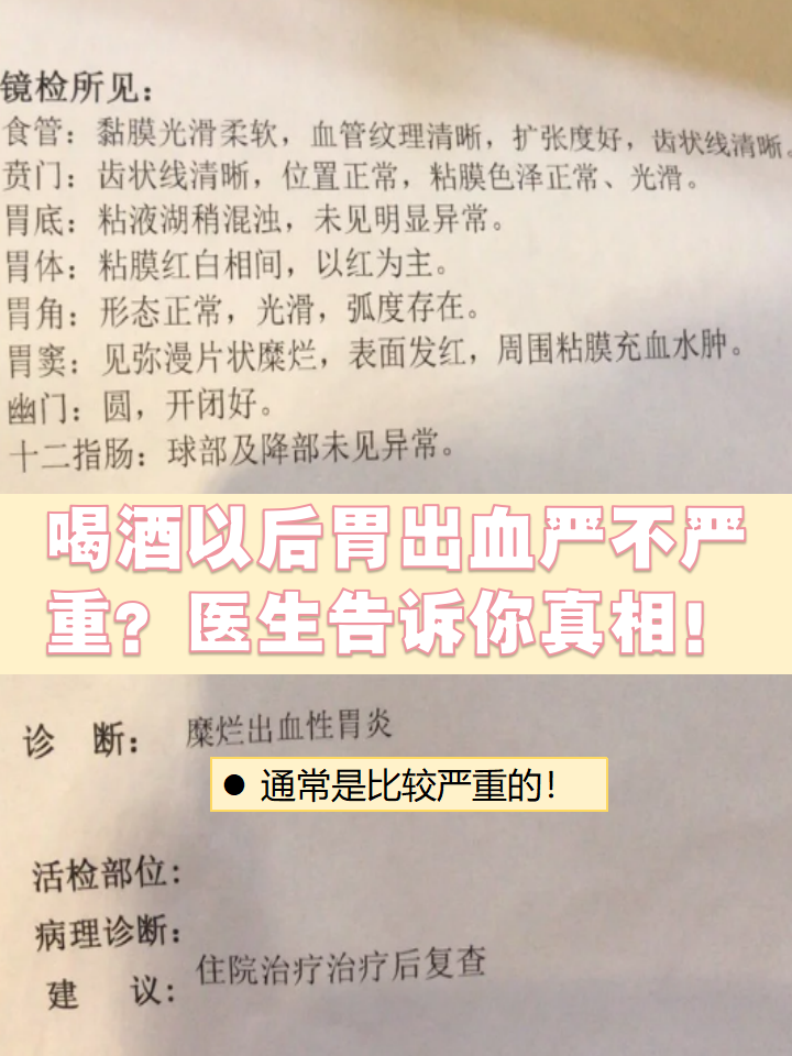 喝酒以后胃出血严不严重?医生告诉你真相!