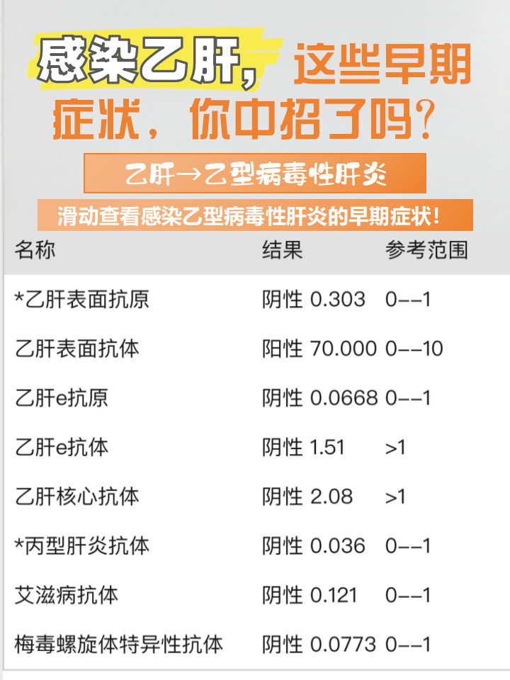 大家知道乙肝吗?医学上一般称为乙型病毒性肝炎