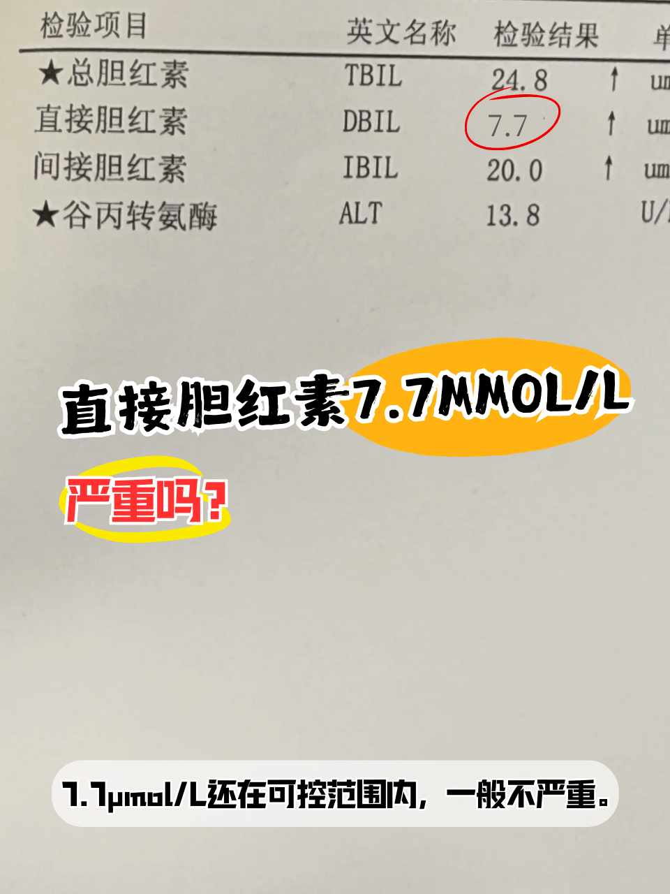 8μmol/l,那"直接胆红素7.7μmol/l"这个数值它到底意味着什么?严重不