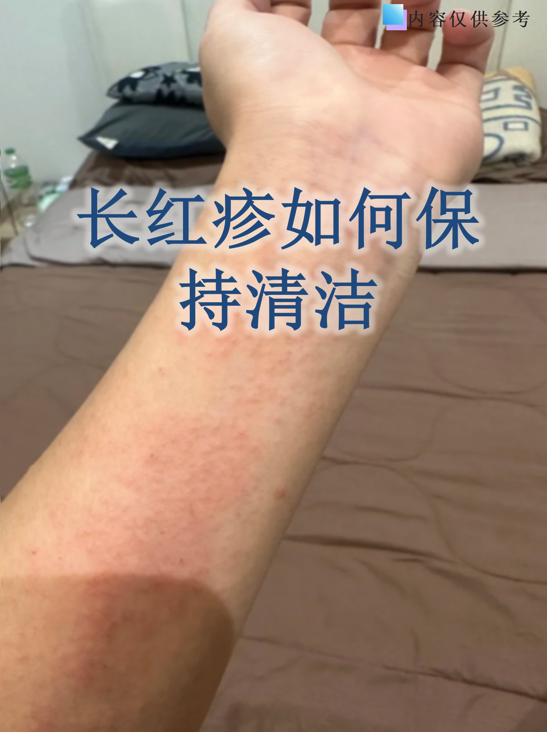 红疹可能由过敏,感染或刺激引起,错误的清洁方式可能加重症状甚至引发