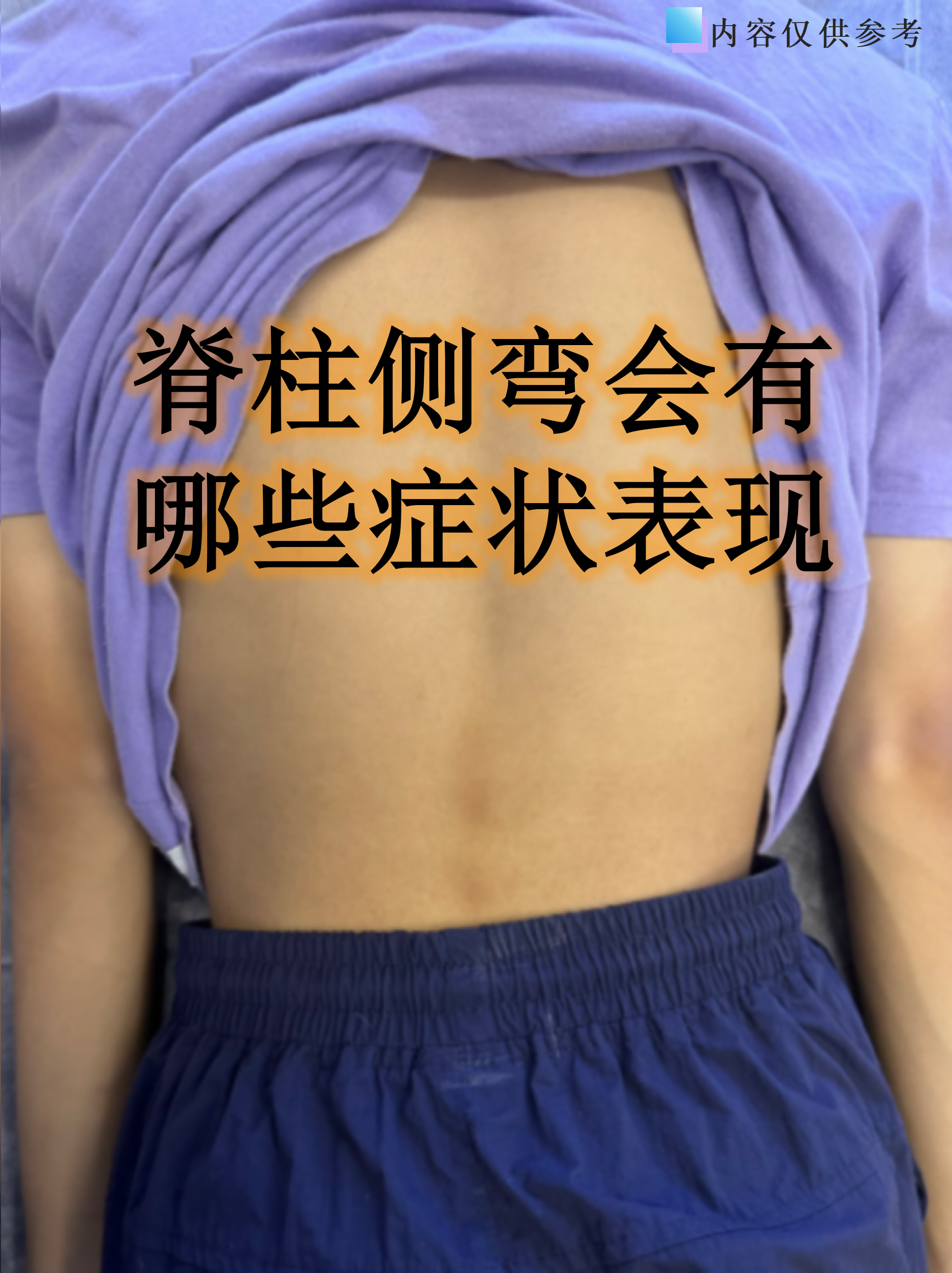 为什么有的人肩膀很平 为什么有的人肩膀很平