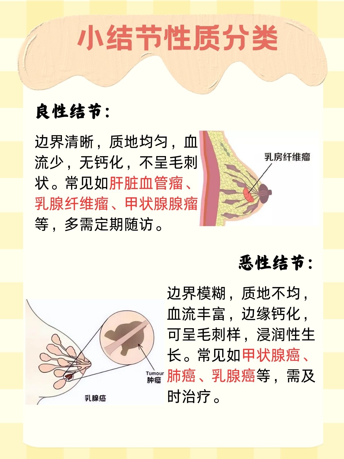 一,小结节的含义 小结节