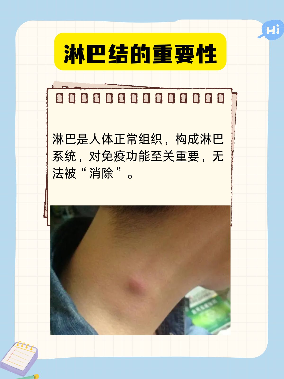 为什么会有淋巴结节的原因为什么在线 为什么会有淋巴结节的原因为什么在线