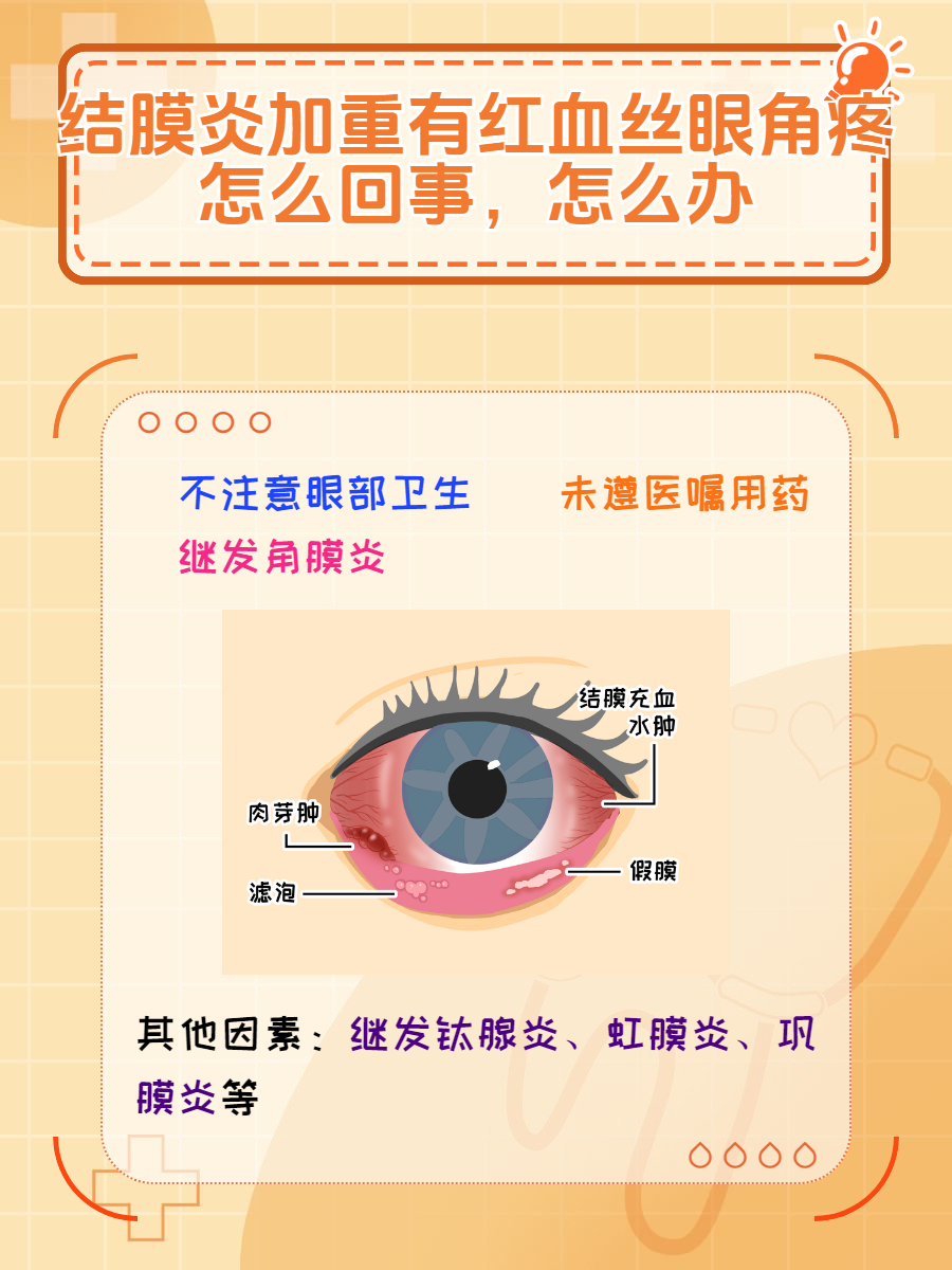 其实我认为导致结膜炎病情