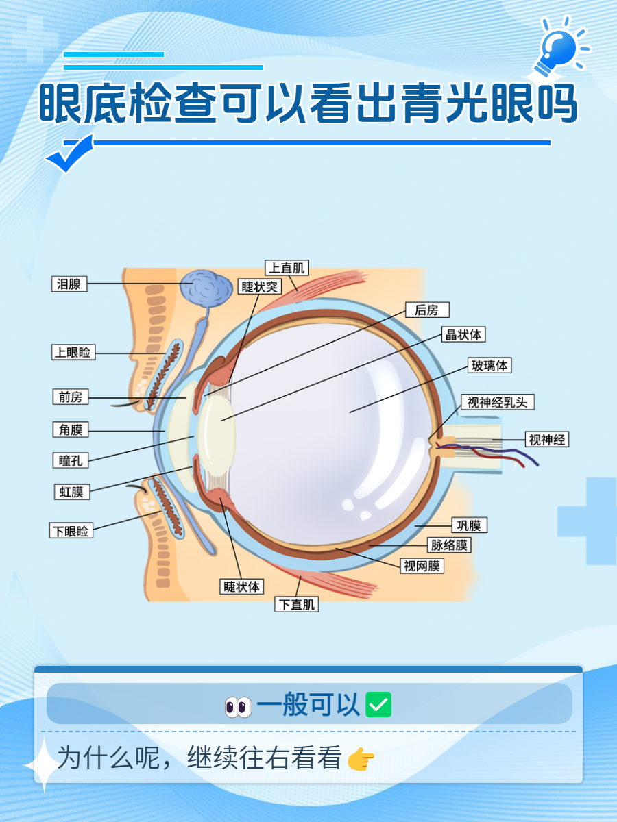 眼底检查可以看出青光眼吗?