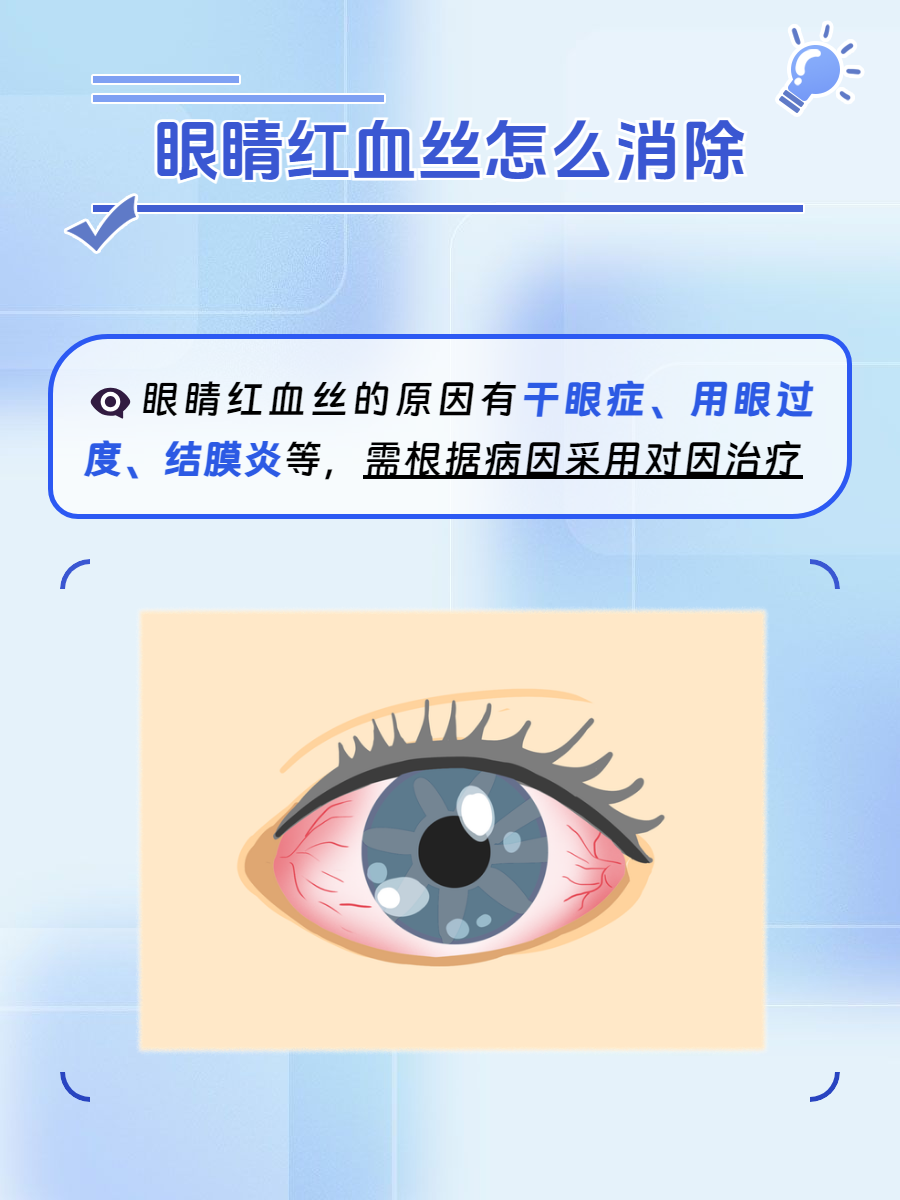 用眼过度,干眼症,结膜炎等因素会让原本清澈明亮的眼睛,布满了细玫哪