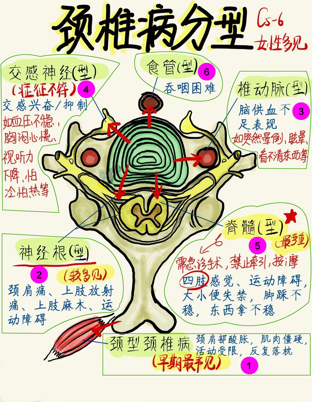 颈椎病分型 建议点赞收藏 颈椎病在我们生活中很常见