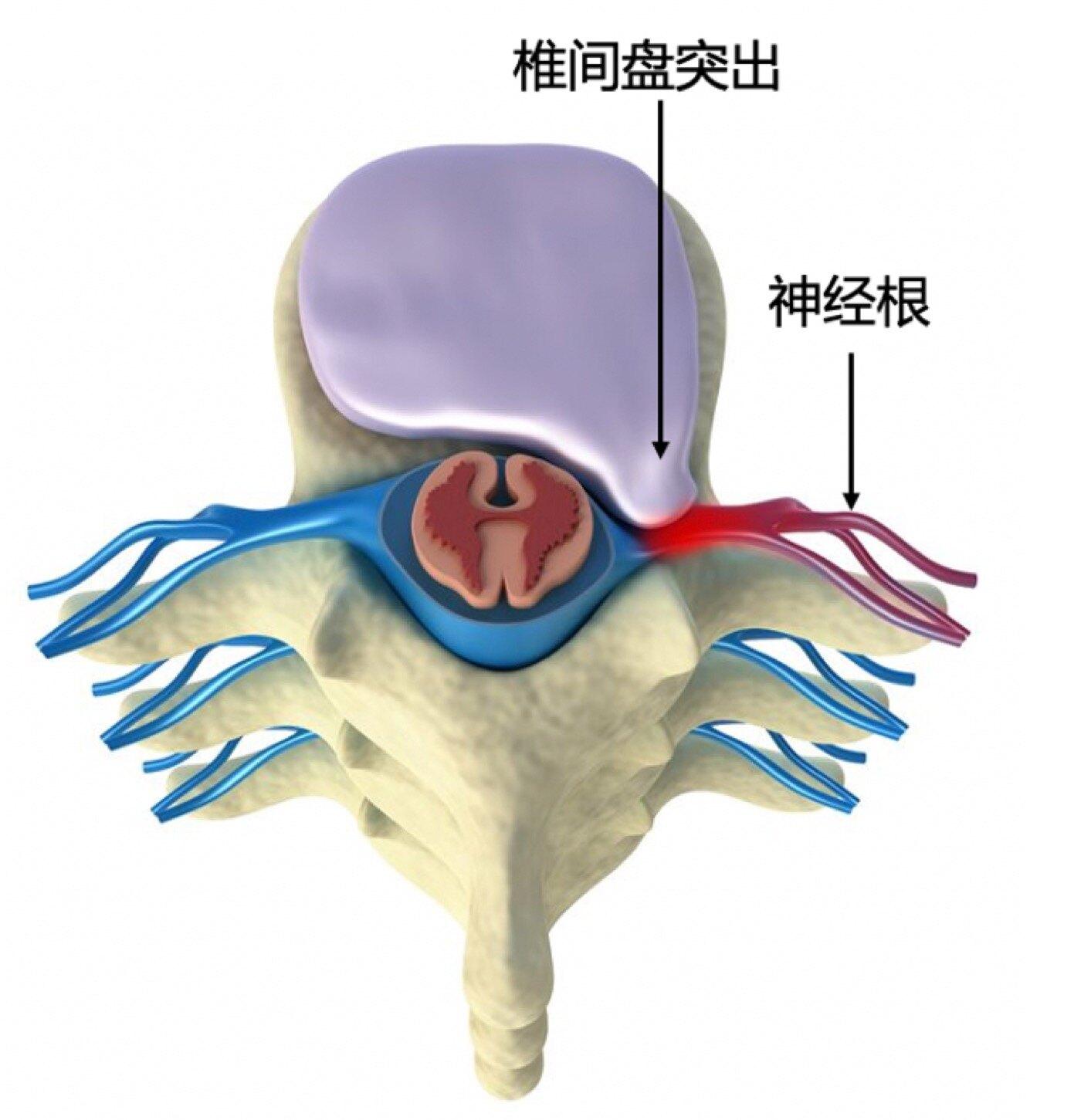 颈椎神经根分布图图片