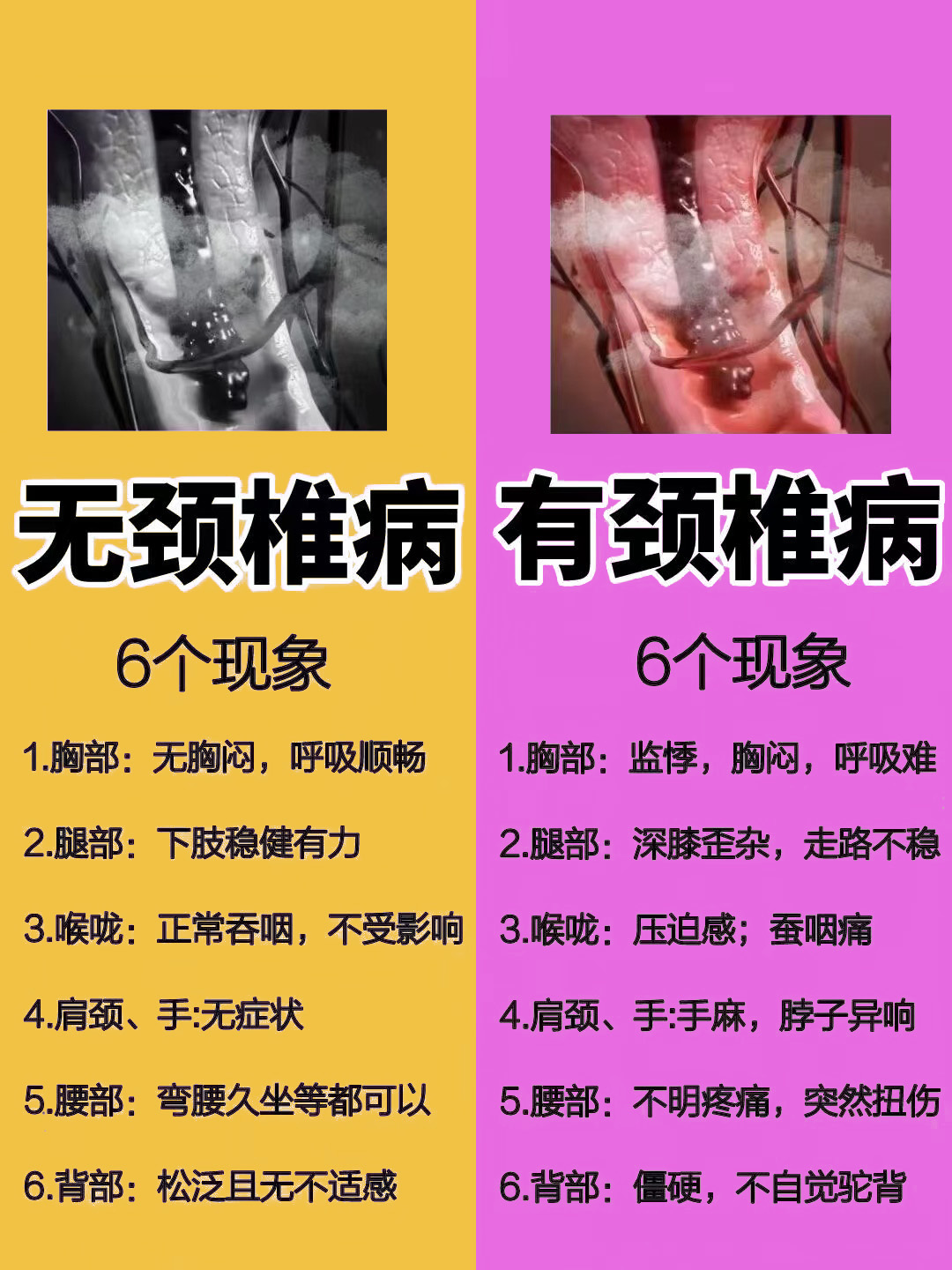 有颈椎病和无颈椎病的6个现象对比