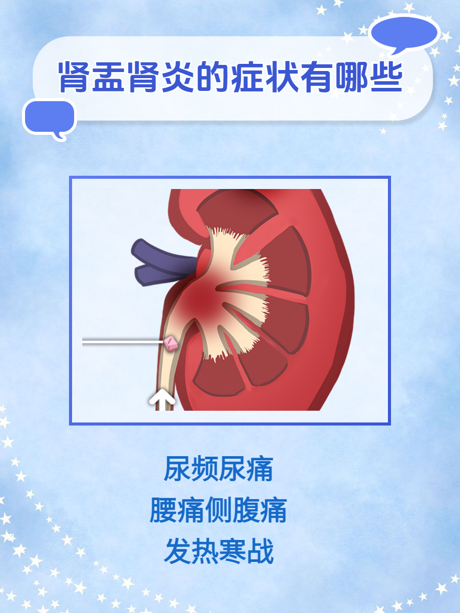 肾绞痛ppt图片