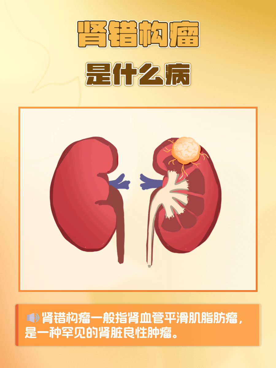 肾错构瘤是什么病?你要知道的小知识  你是否听说过肾错构瘤?