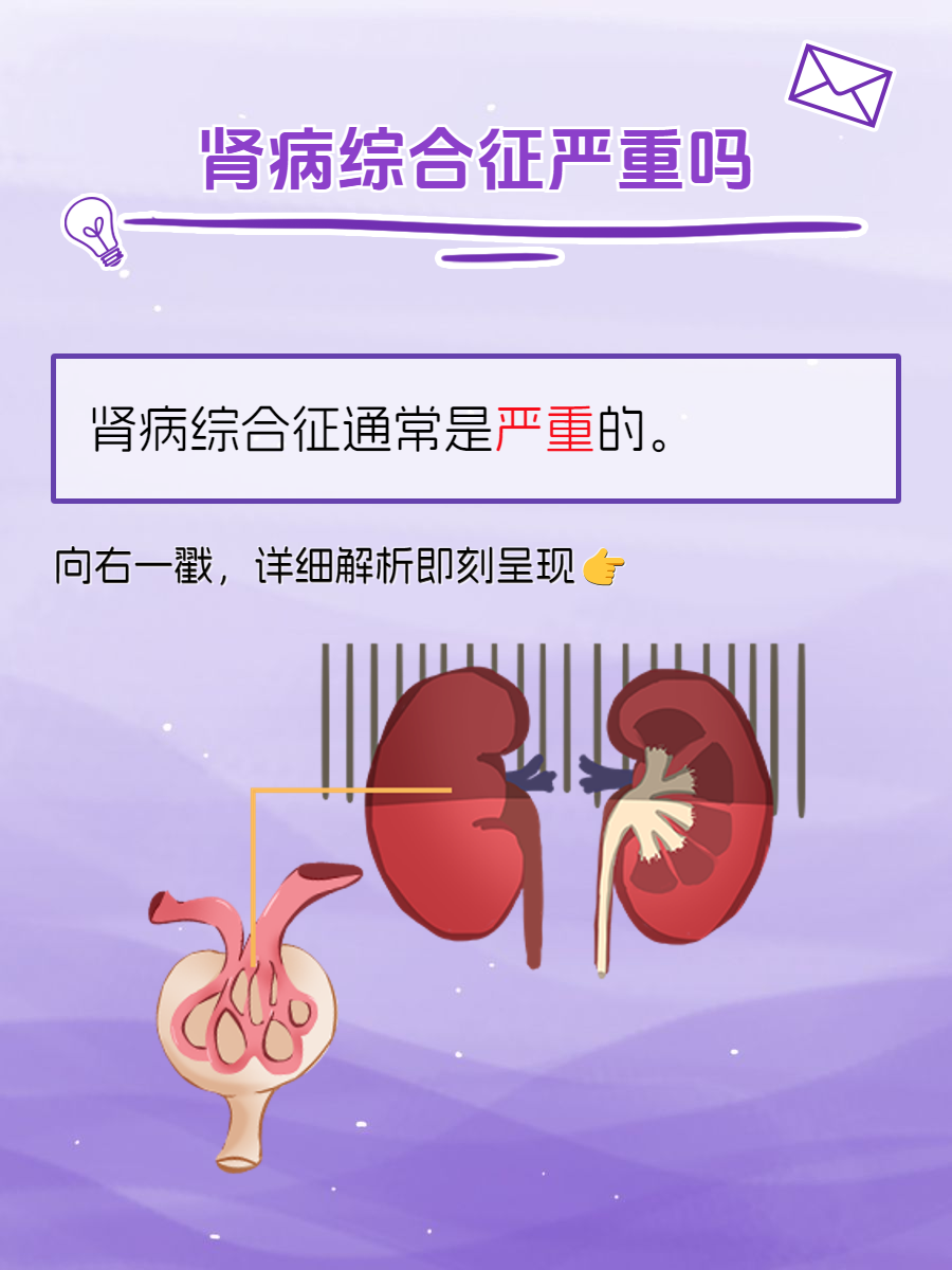 肾病综合征严重吗?