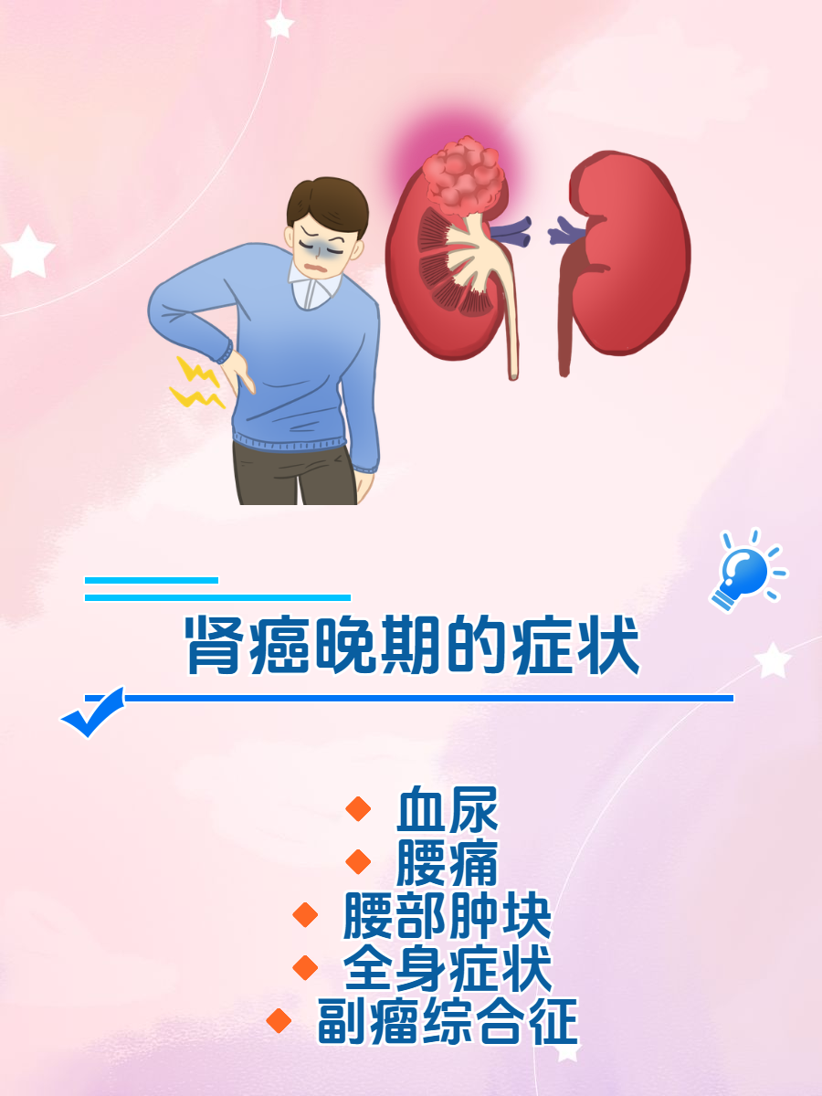 肾癌会遗传吗图片