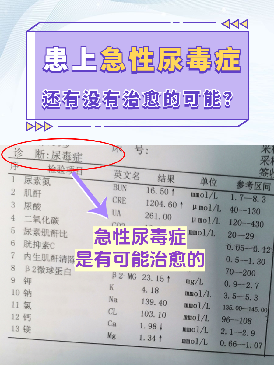 急性尿毒症并非一个独立