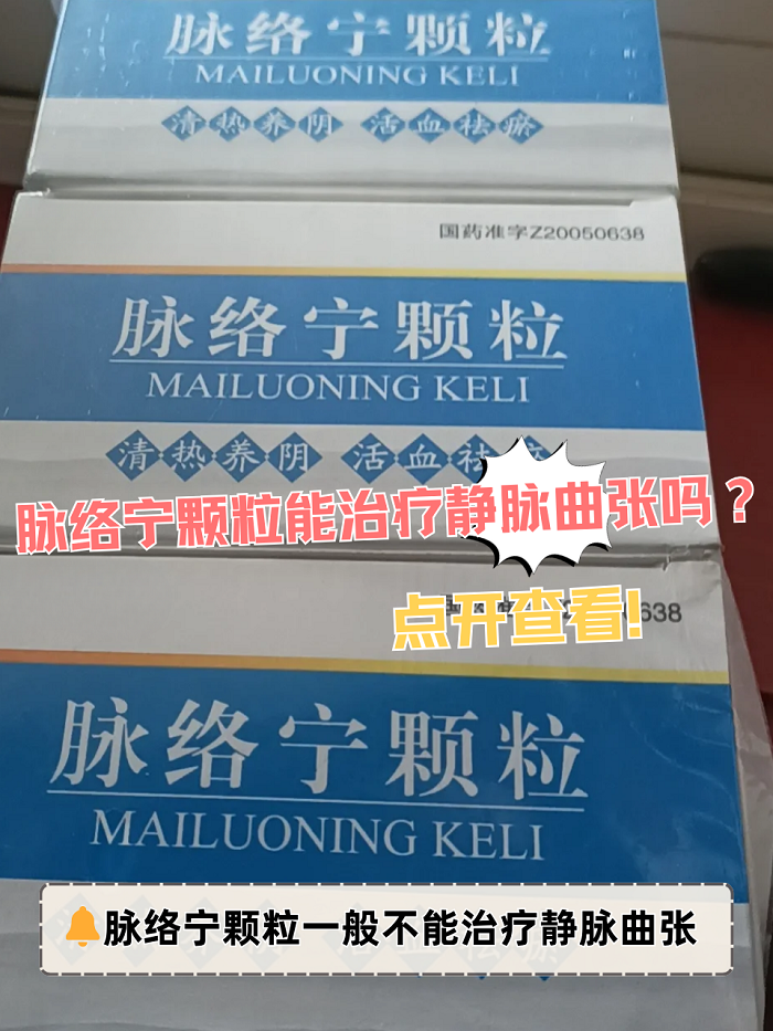 脉络宁颗粒能治疗静脉曲张吗?点开查看!