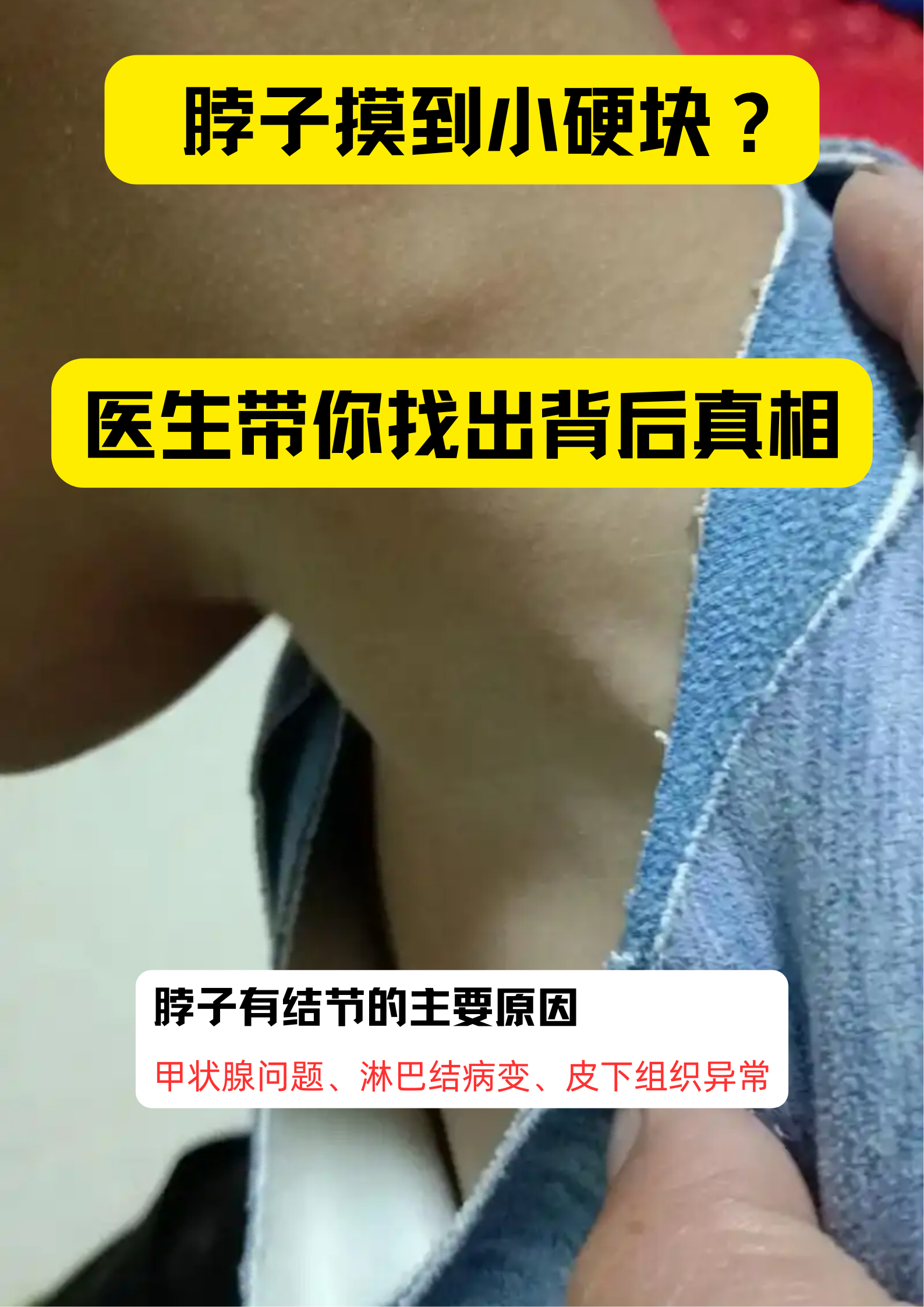 脖子出现结节,主要与甲状腺疾病,淋巴结病变,皮下组织异常增生等因素