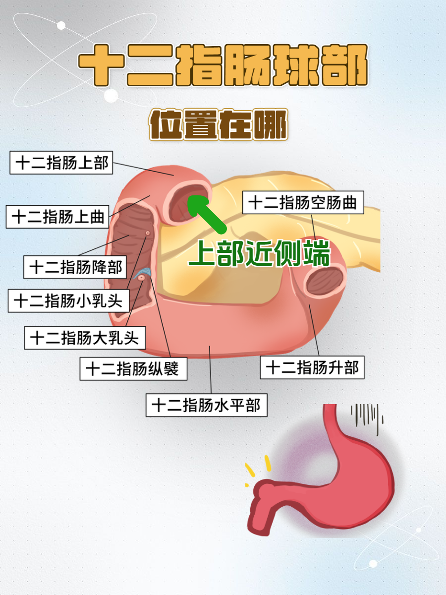 十二指肠球部位置在哪?