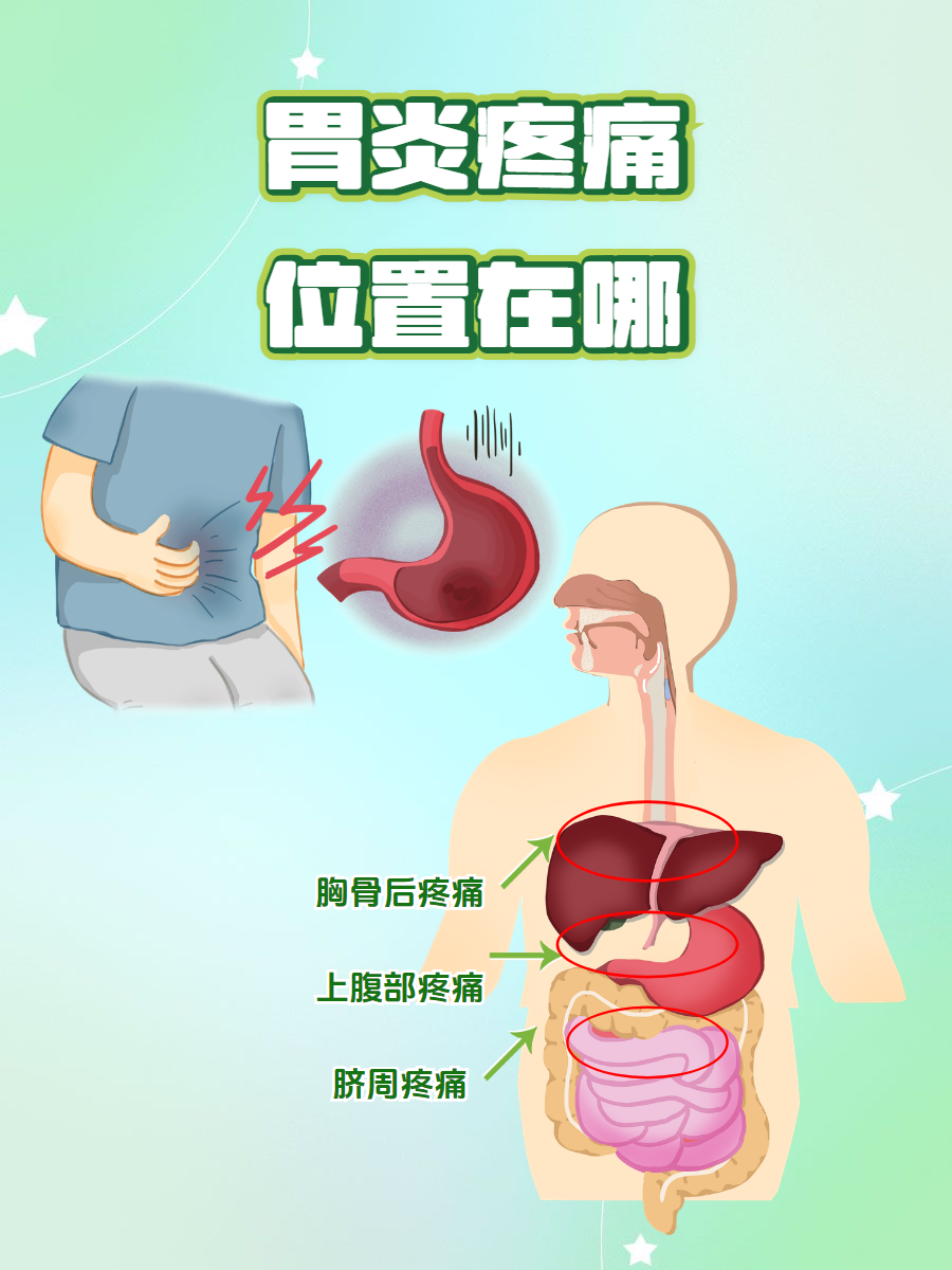 胃炎疼痛的位置主要集中在医岢ρ 疼痛位置图胃疼是哪个部位疼图片
