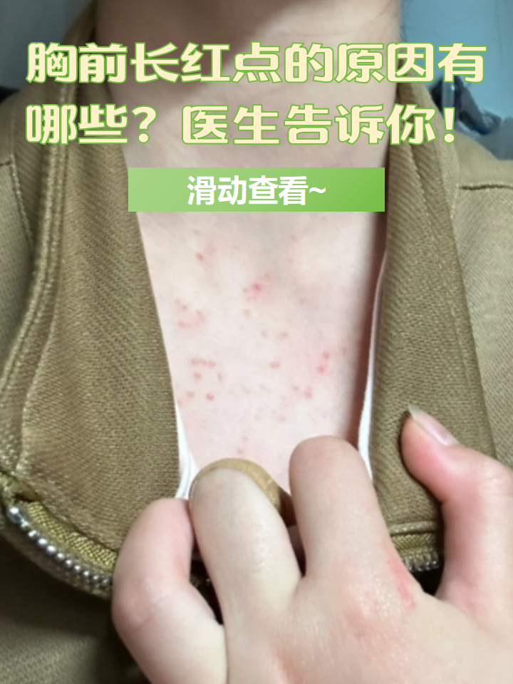 通常有以下几个原因: 毛囊炎 湿疹 蜘蛛痣 针对上述原因,通常可以在