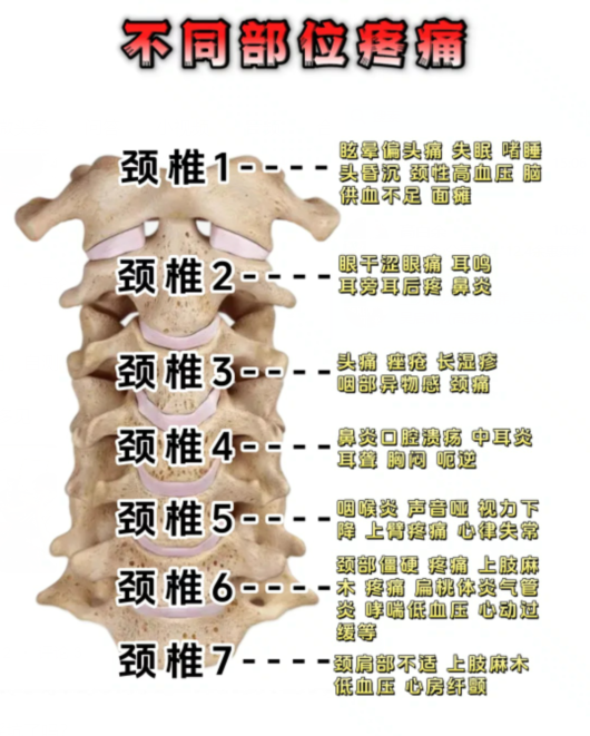 什么意思颈椎第一节颈椎神经支配图口诀颈椎病早头痛头晕为何要查颈椎