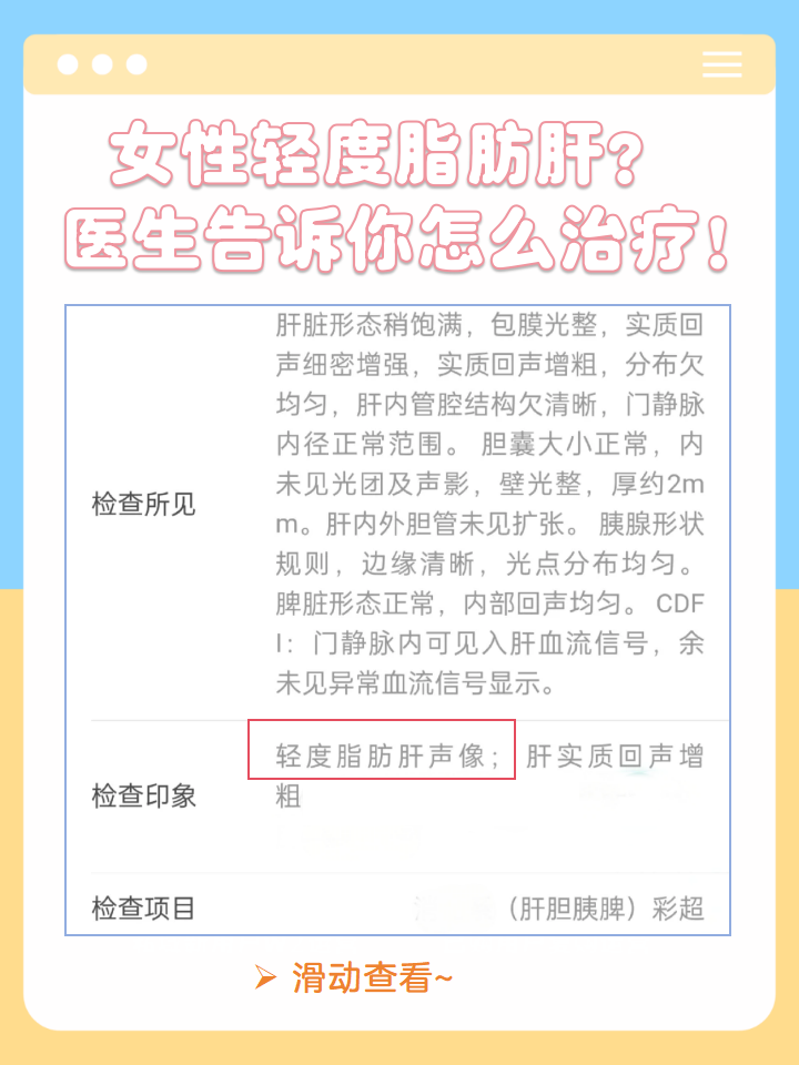 简单来说,就是肝脏内堆积了过多的脂肪,导致肝细胞受损的一种病理状态