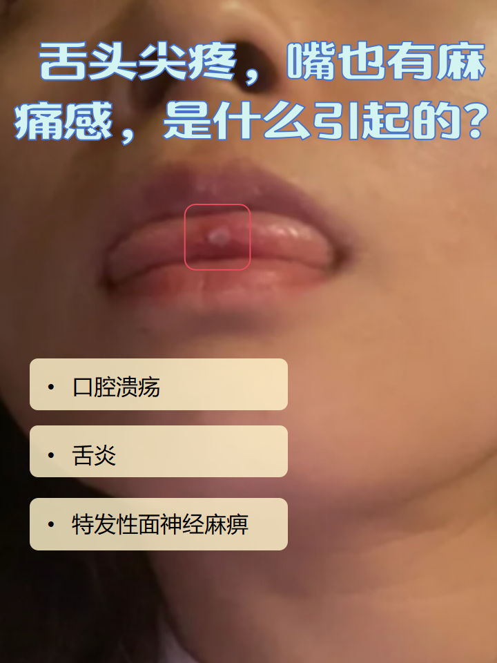 为什么舌头会痛